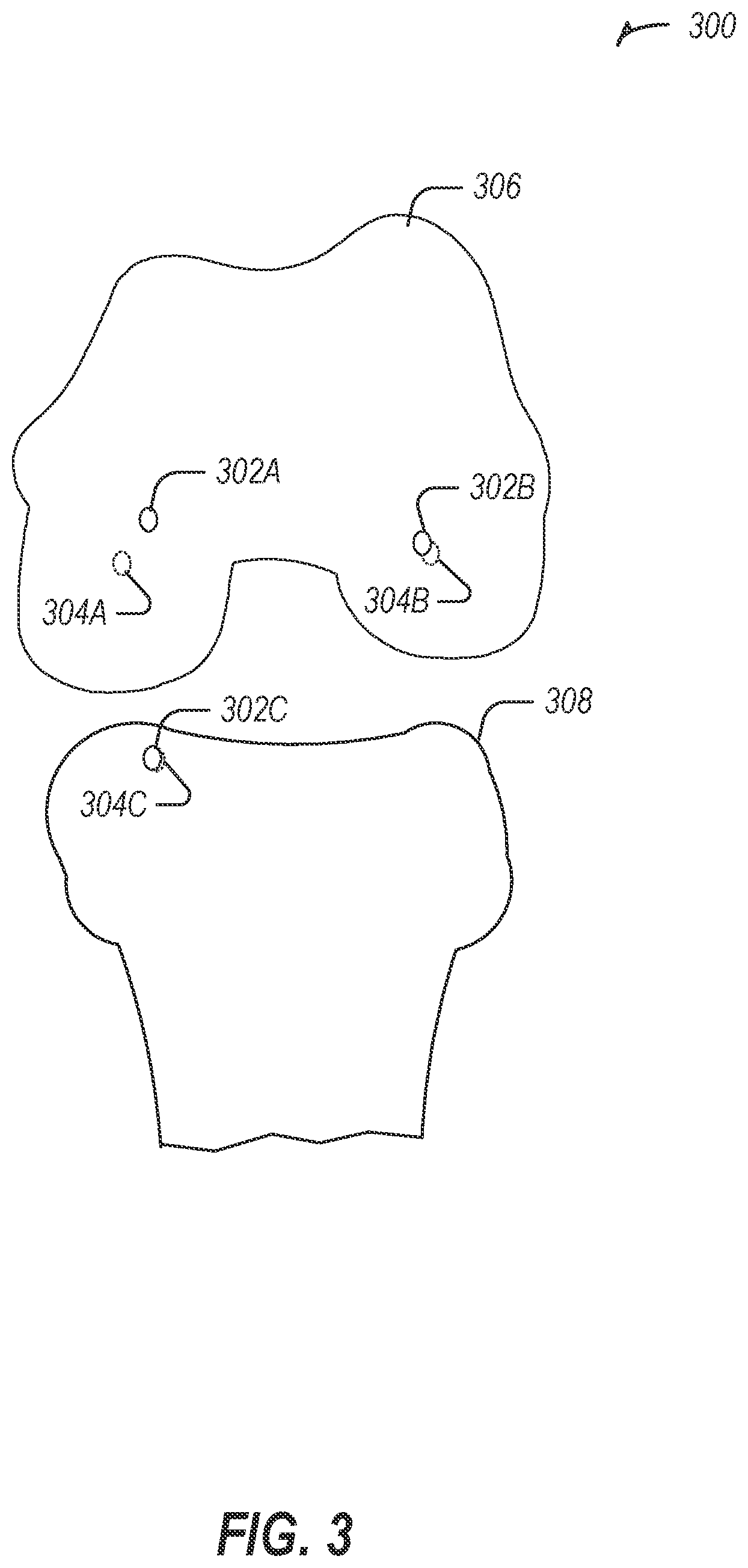 Patent US12376919 Figure 3 – Robotic device and sterilization unit for surgical instrument