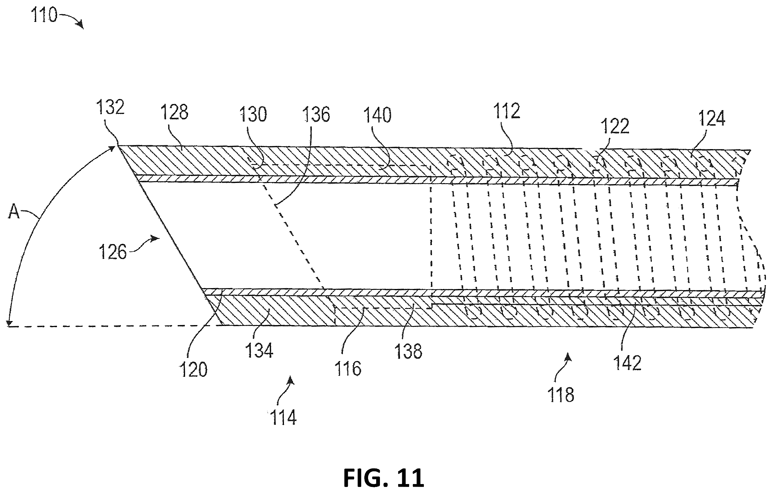 Patent US12376928 Figure 11 – Catheter drive system for supra-aortic access