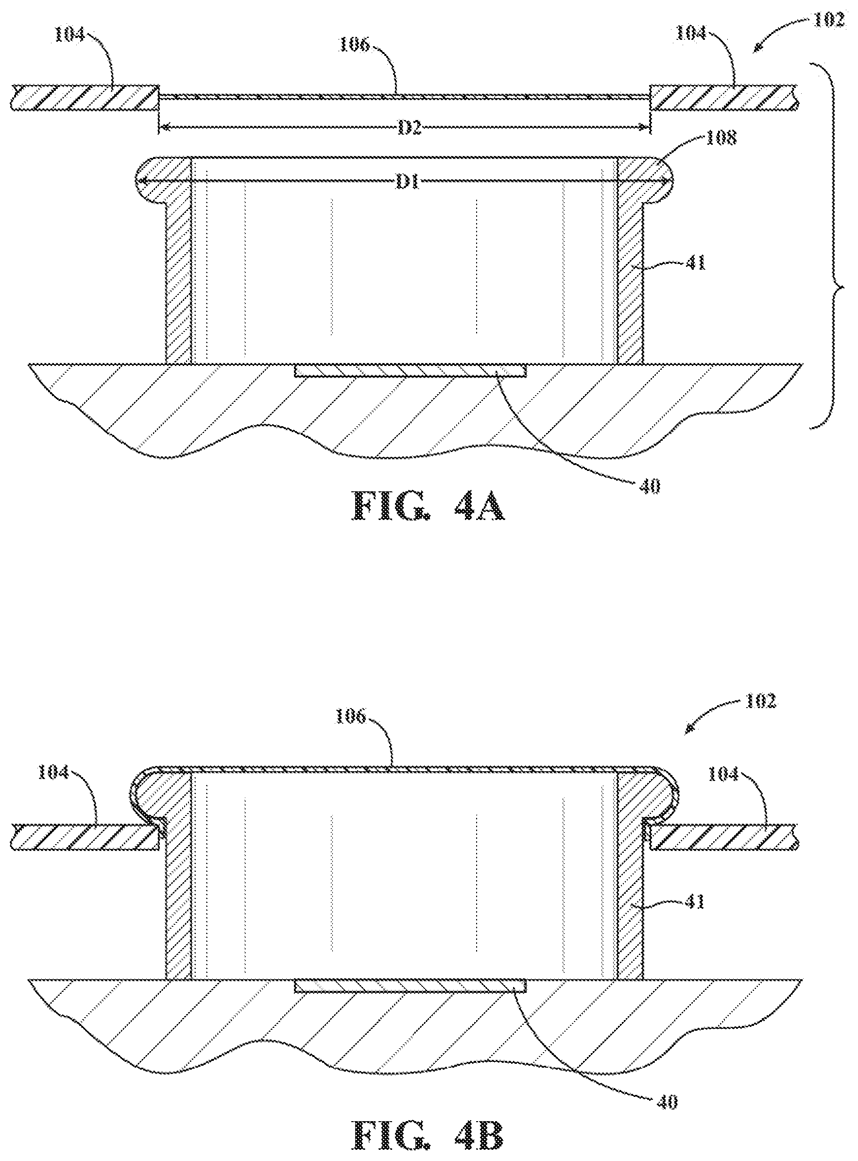 Patent US12376931 Figure 3 – Assembly for positioning a sterile surgical drape relative to optical position sensors