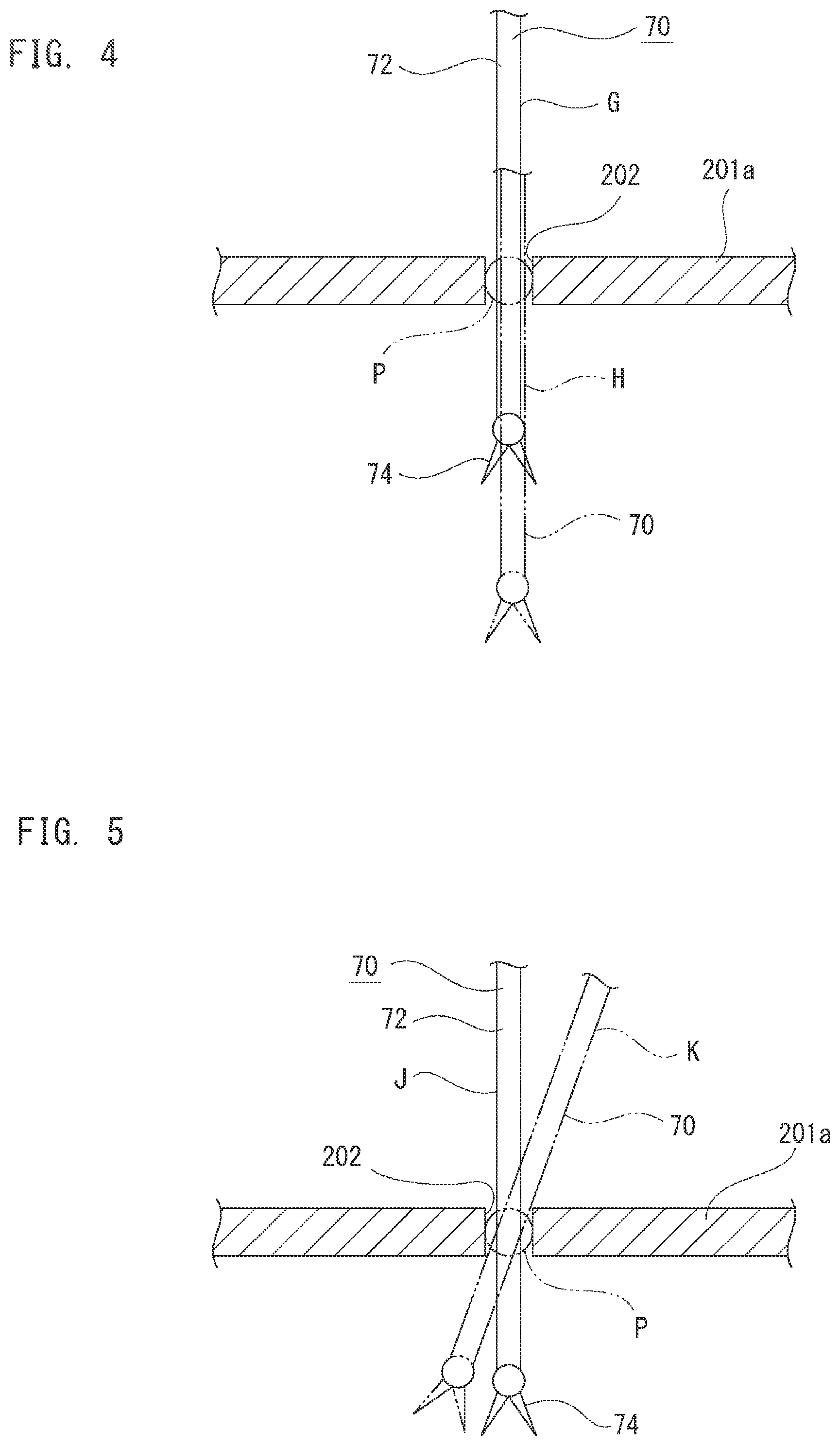 Patent US12376935 Figure 4 – Surgery-assisting device