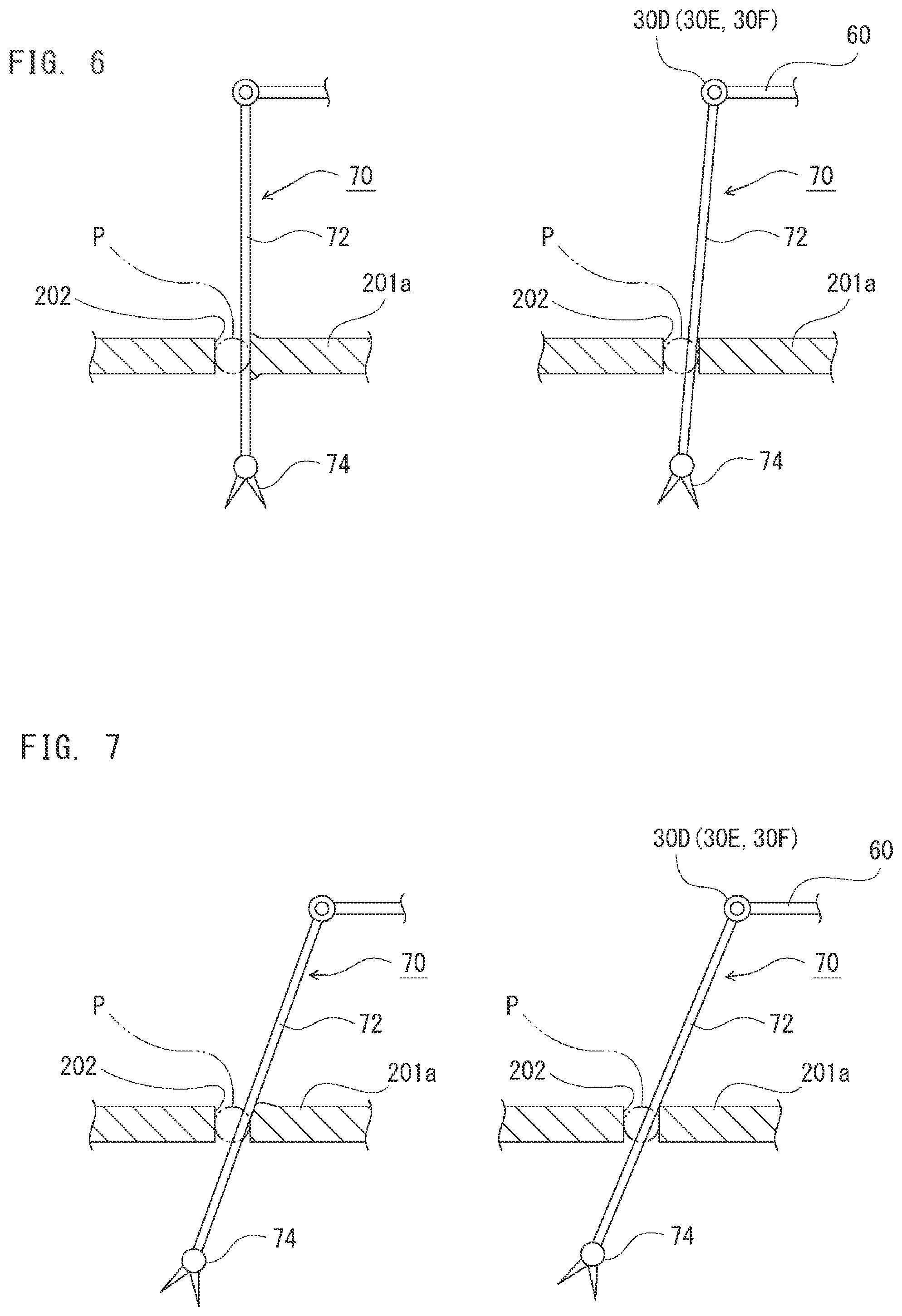 Patent US12376935 Figure 5 – Surgery-assisting device