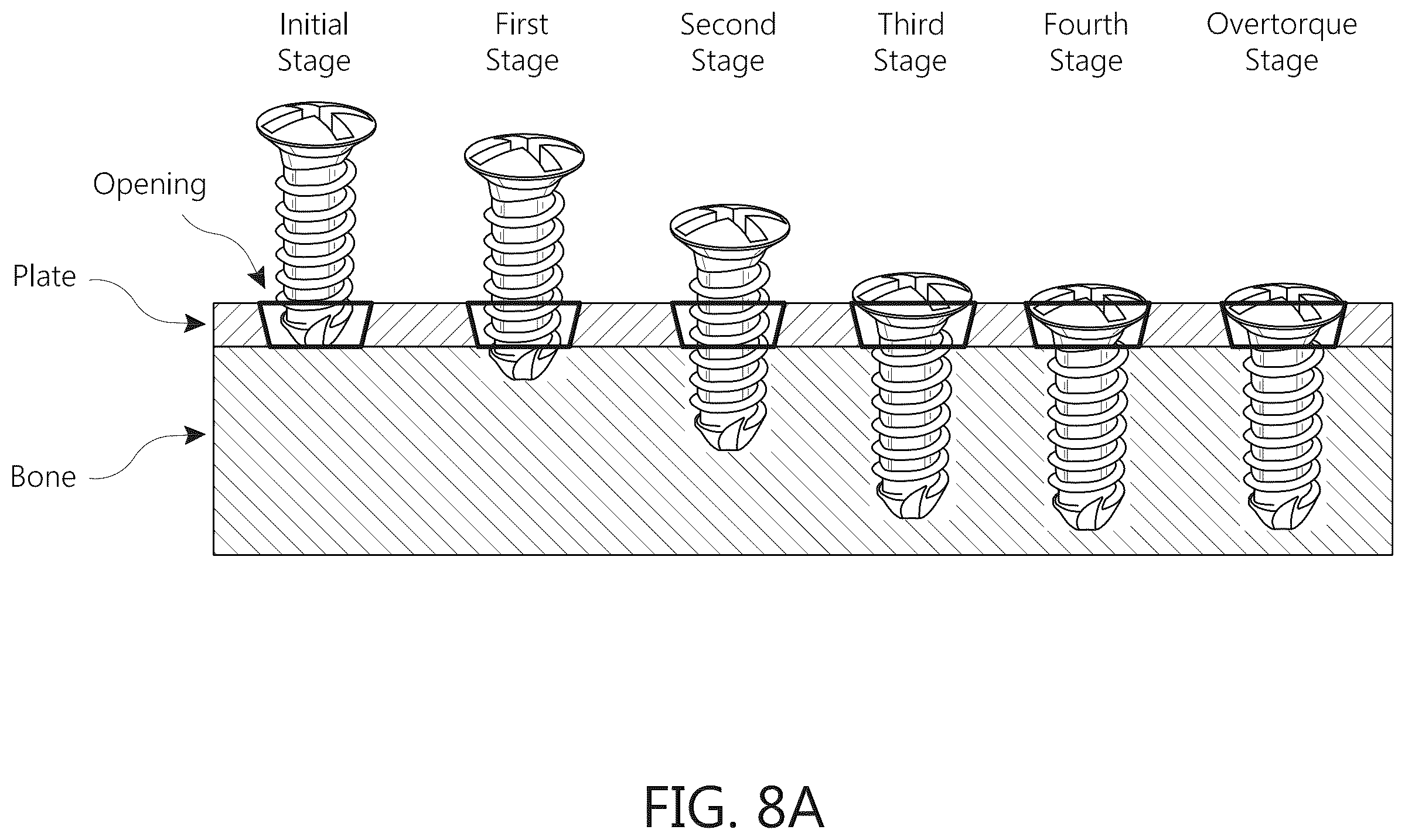 Patent US12376936 Figure 7 – Torque-limiting screwdriver devices, systems, and methods