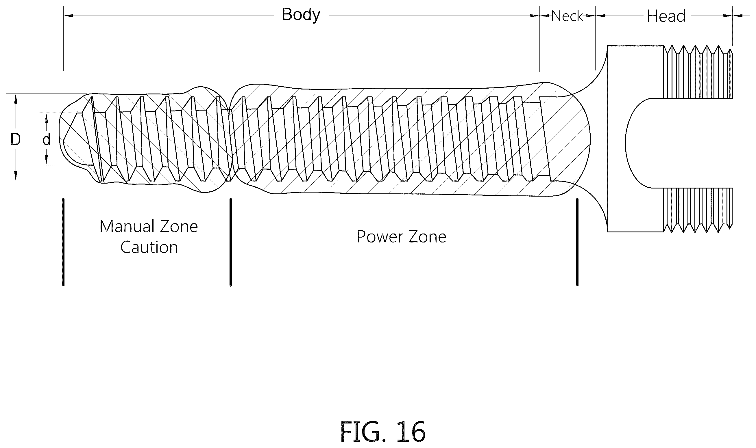 Patent US12376936 Figure 19 – Torque-limiting screwdriver devices, systems, and methods