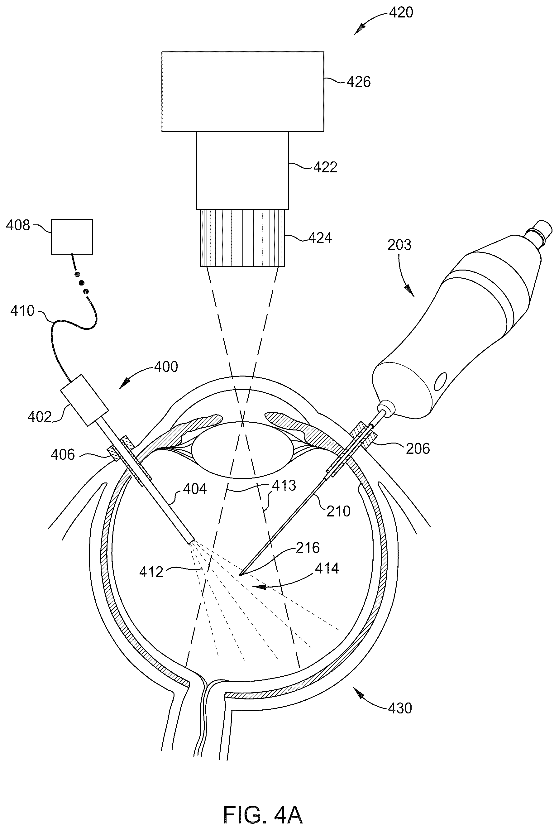 Patent US12376937 Figure 4 – Ophthalmic surgical microscope with stroboscopic illumination