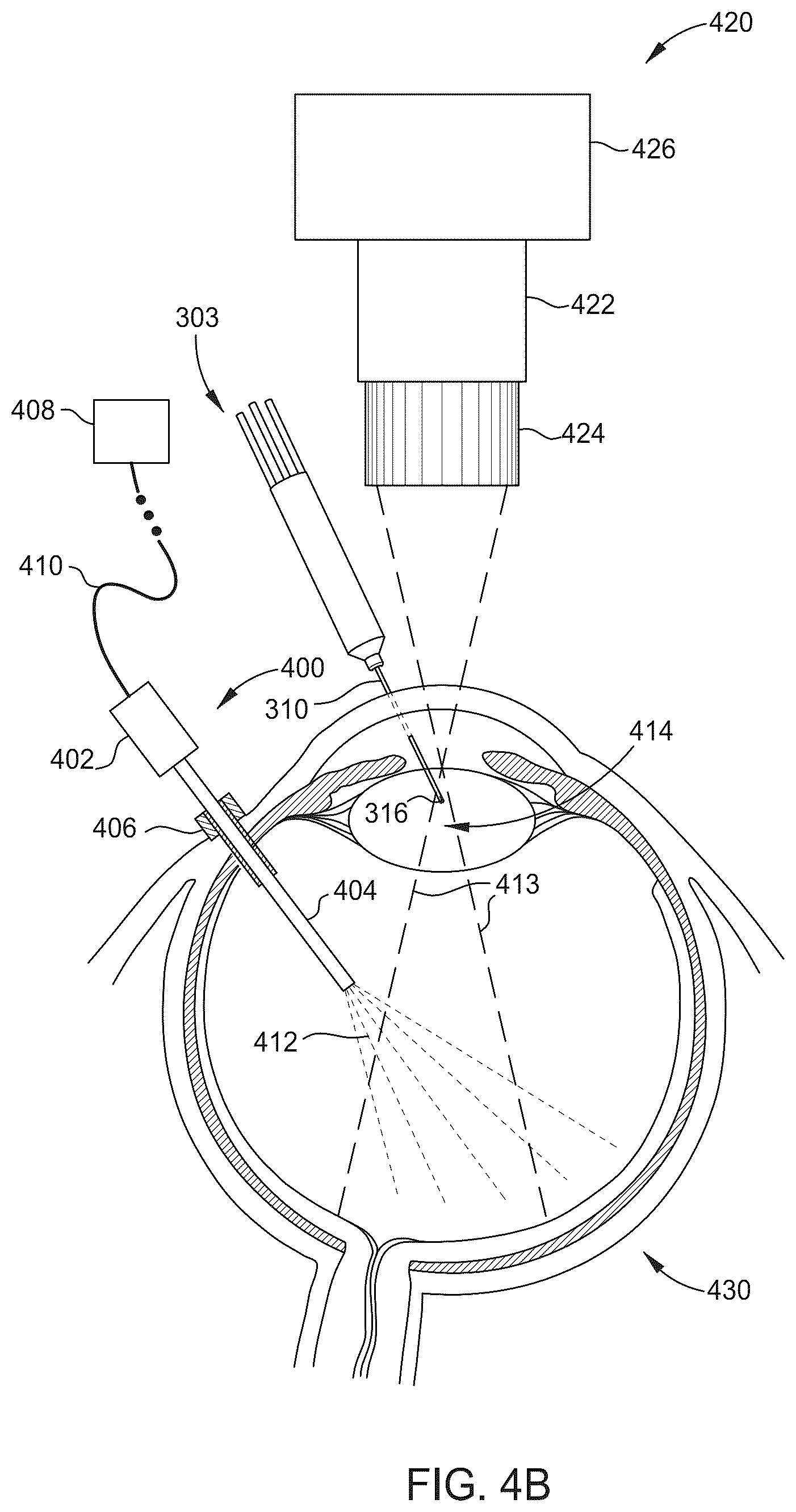 Patent US12376937 Figure 5 – Ophthalmic surgical microscope with stroboscopic illumination