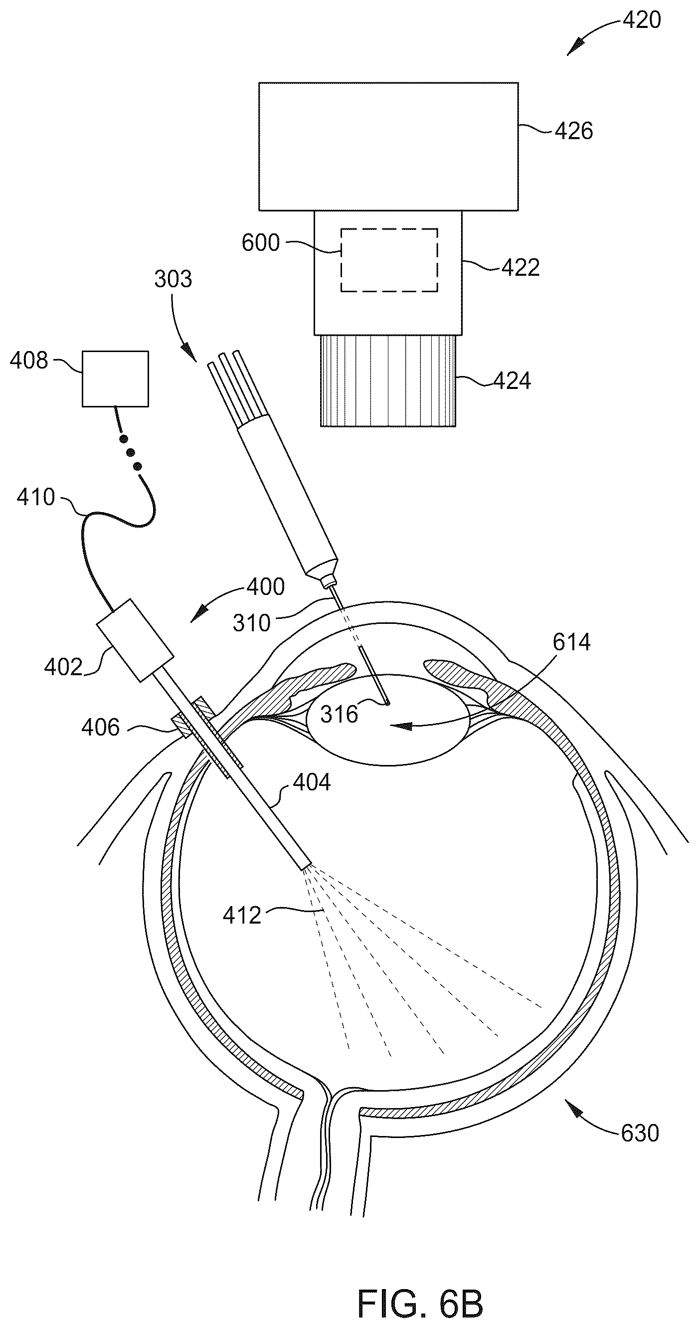 Patent US12376937 Figure 9 – Ophthalmic surgical microscope with stroboscopic illumination