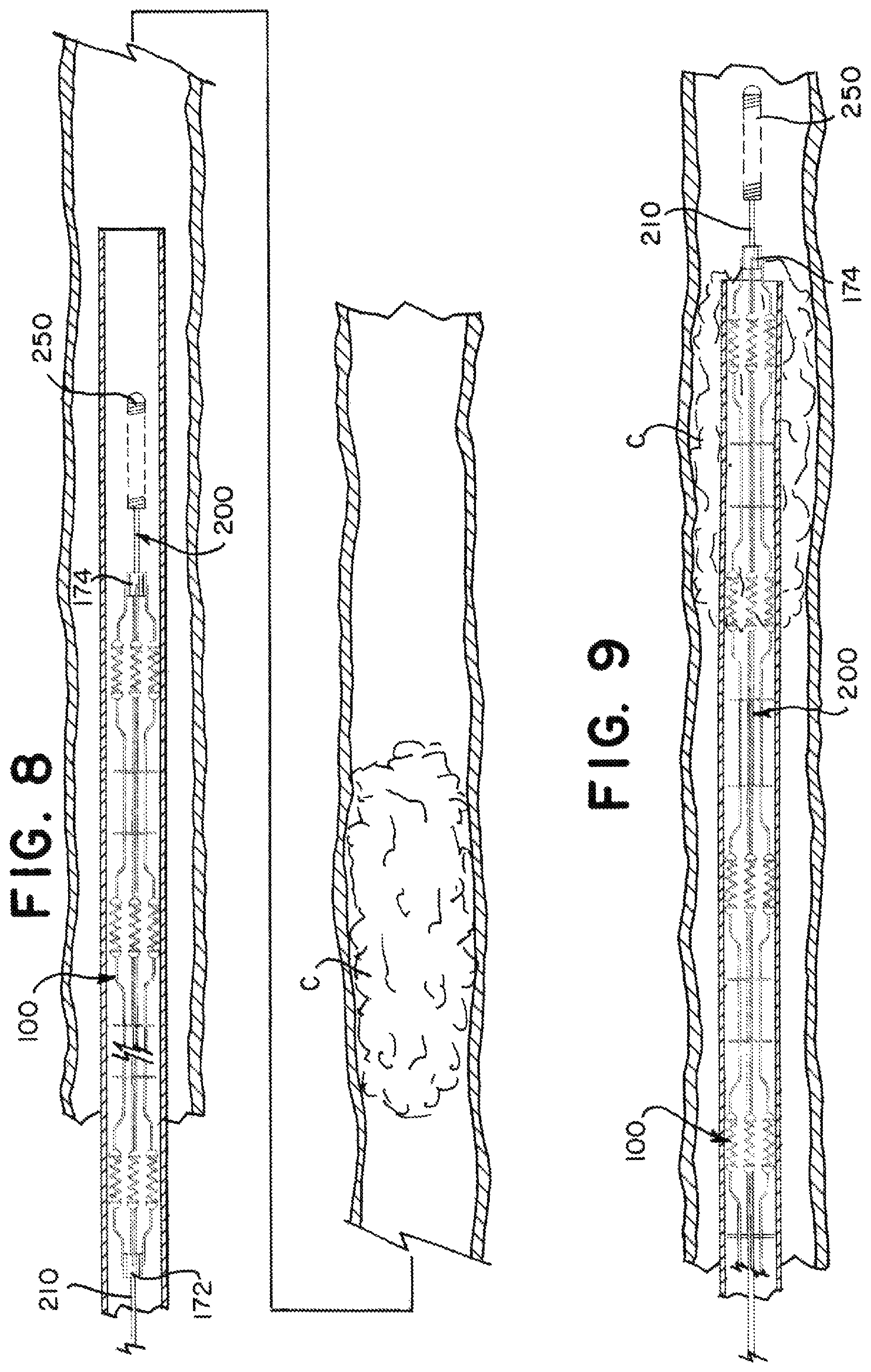 Patent US12376938 Figure 7 – Intravascular devices with radiopaque body markers