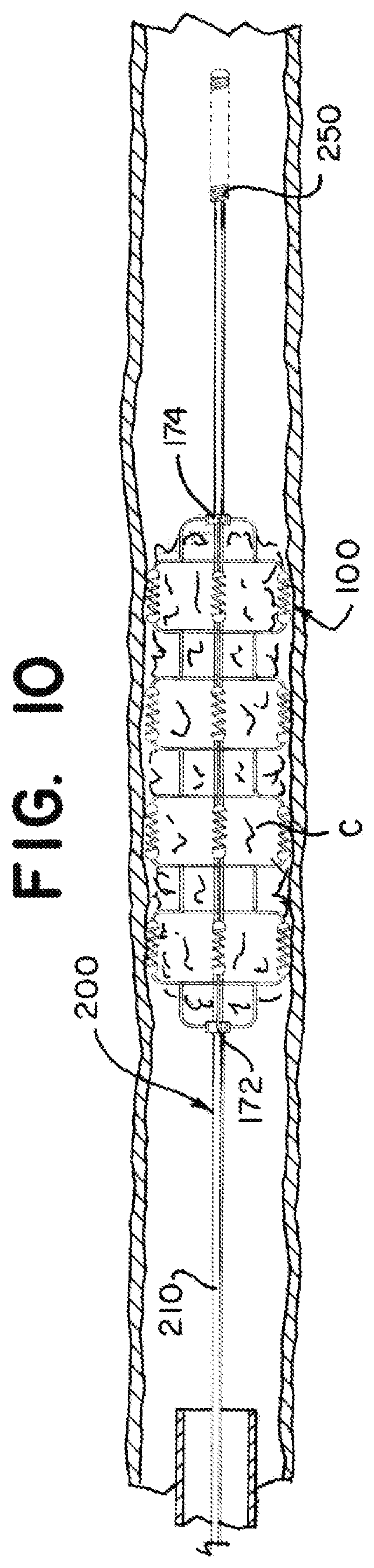 Patent US12376938 Figure 8 – Intravascular devices with radiopaque body markers