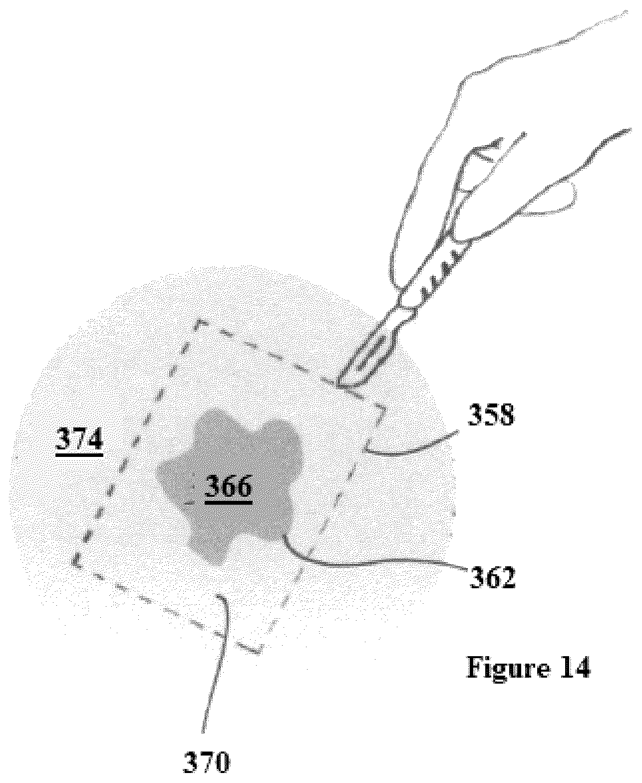 Patent US12376939 Figure 10 – Method of marking a specimen
