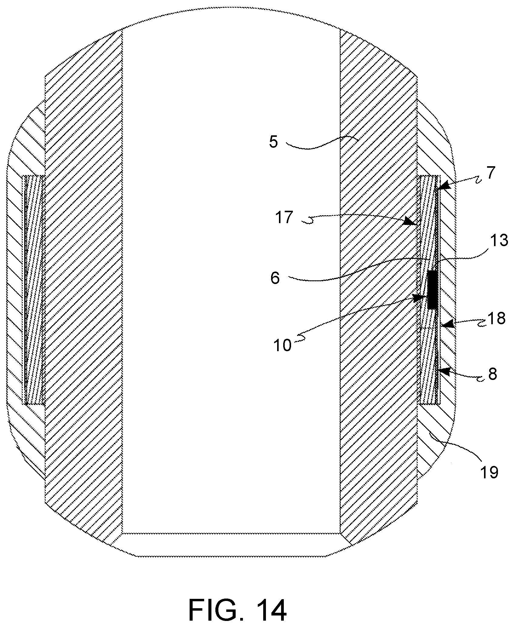 Patent US12376941 Figure 10 – Insert assembly with radiofrequency identifier for medical device