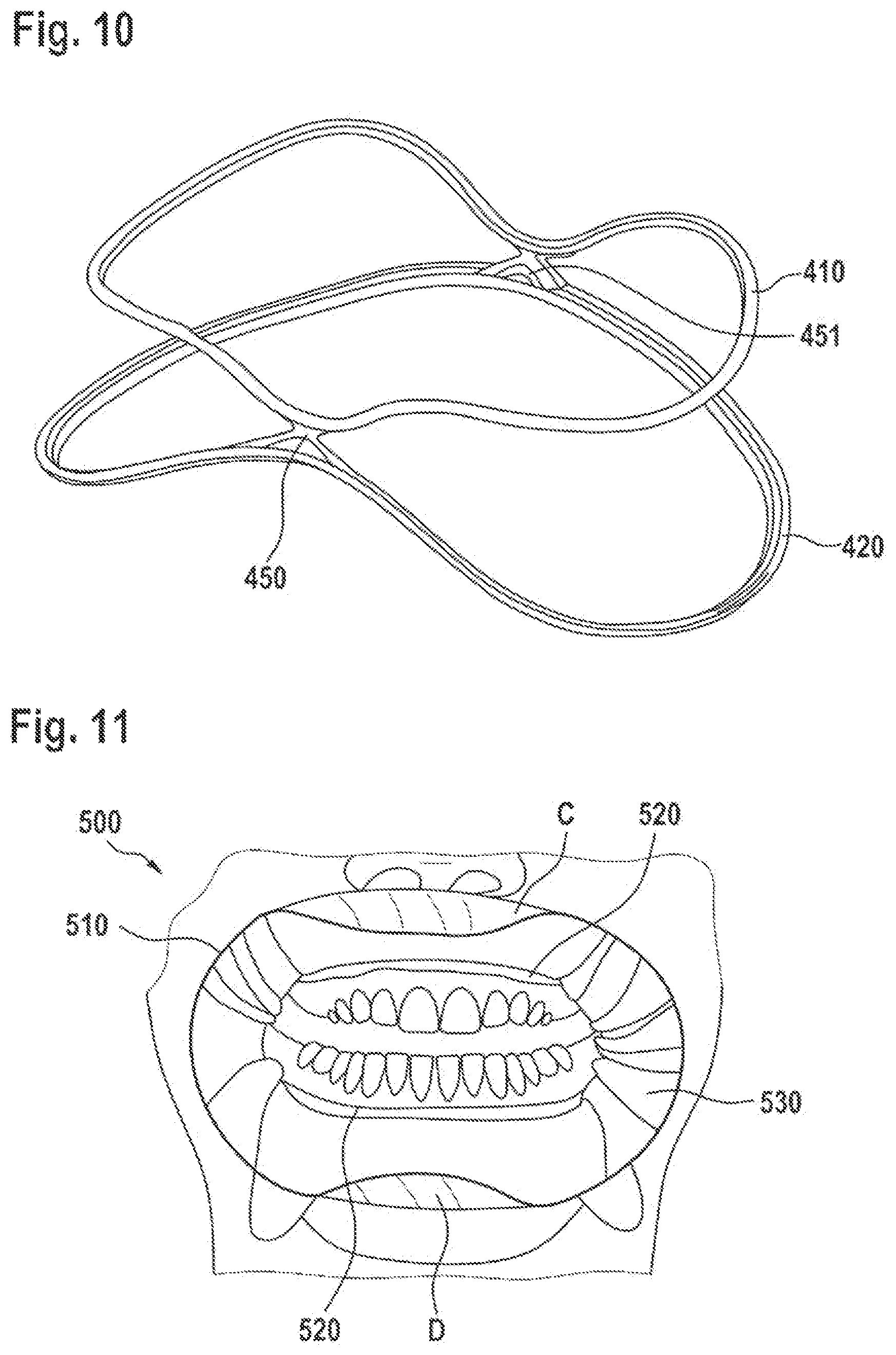 Patent US12376942 Figure 6 – Lip and cheek extender