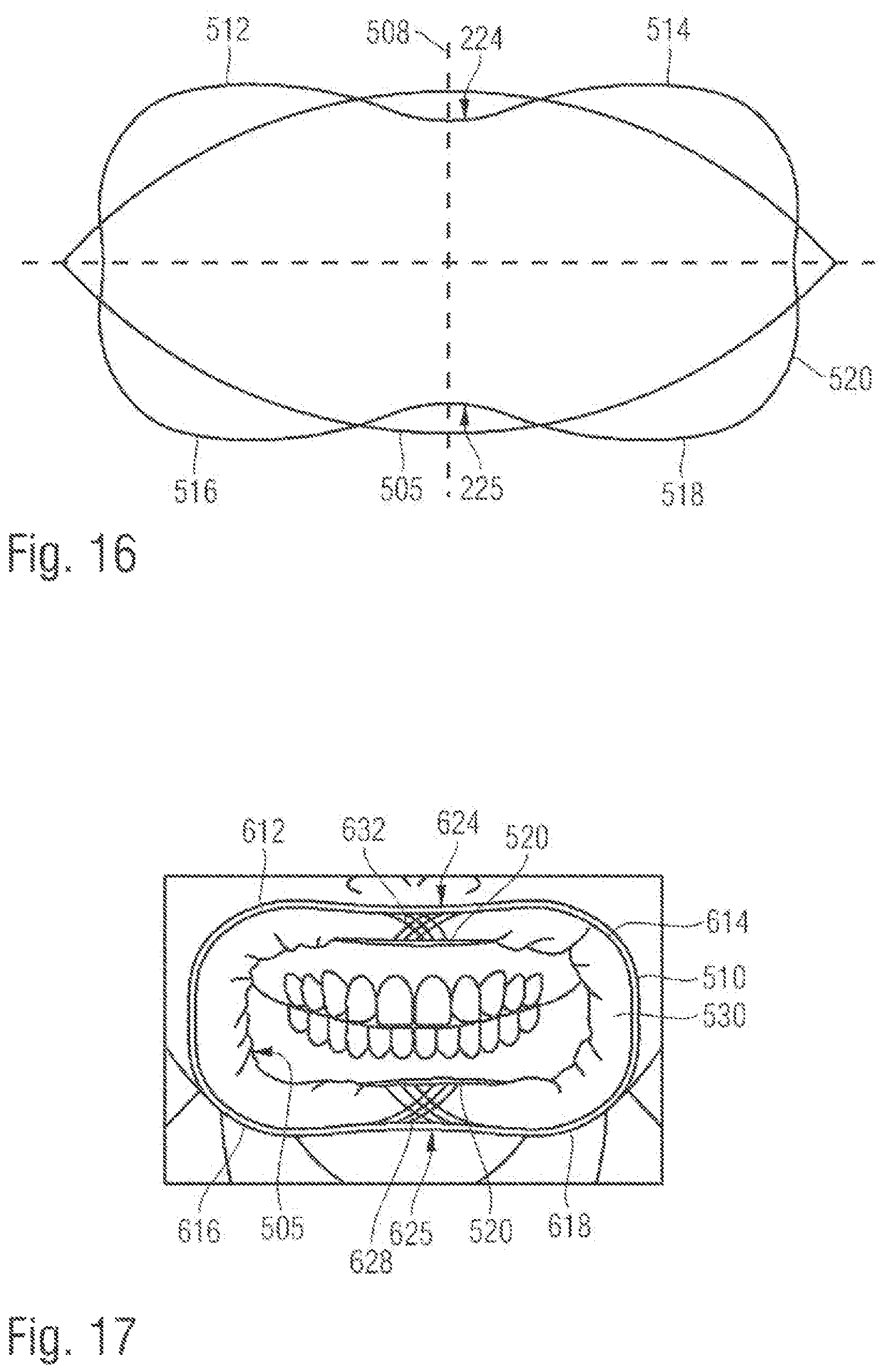 Patent US12376942 Figure 9 – Lip and cheek extender