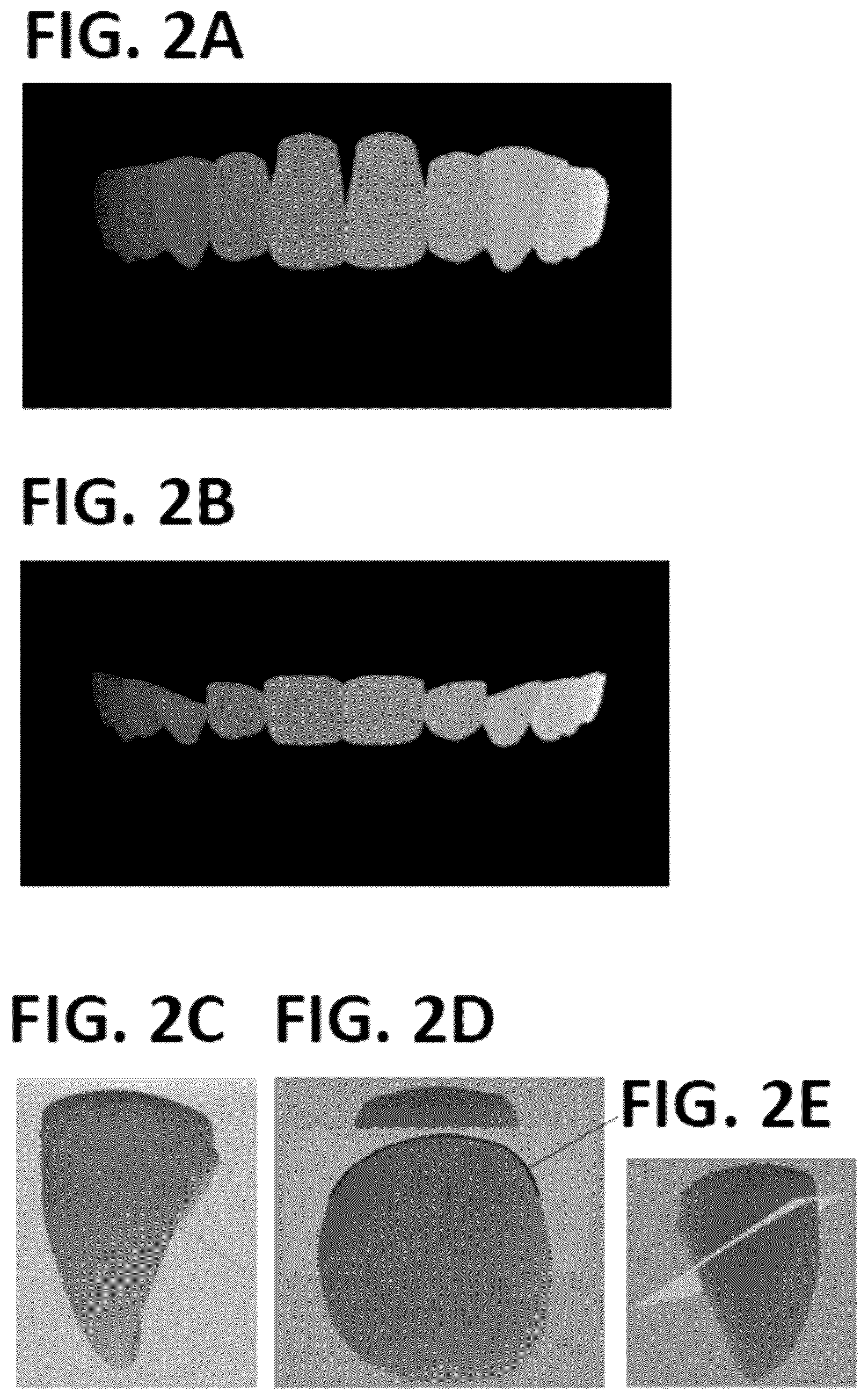 Patent US12376943 Figure 7 – Methods and systems for forming a three-dimensional model of dentition