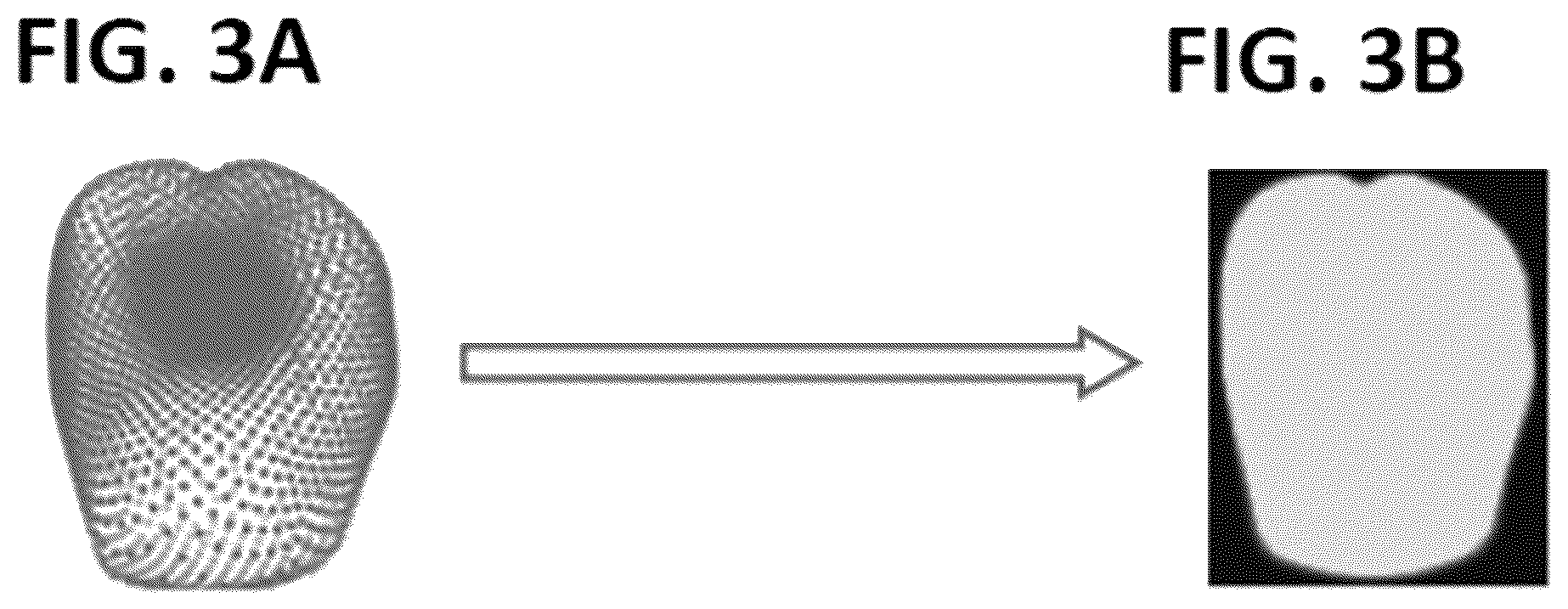Patent US12376943 Figure 8 – Methods and systems for forming a three-dimensional model of dentition