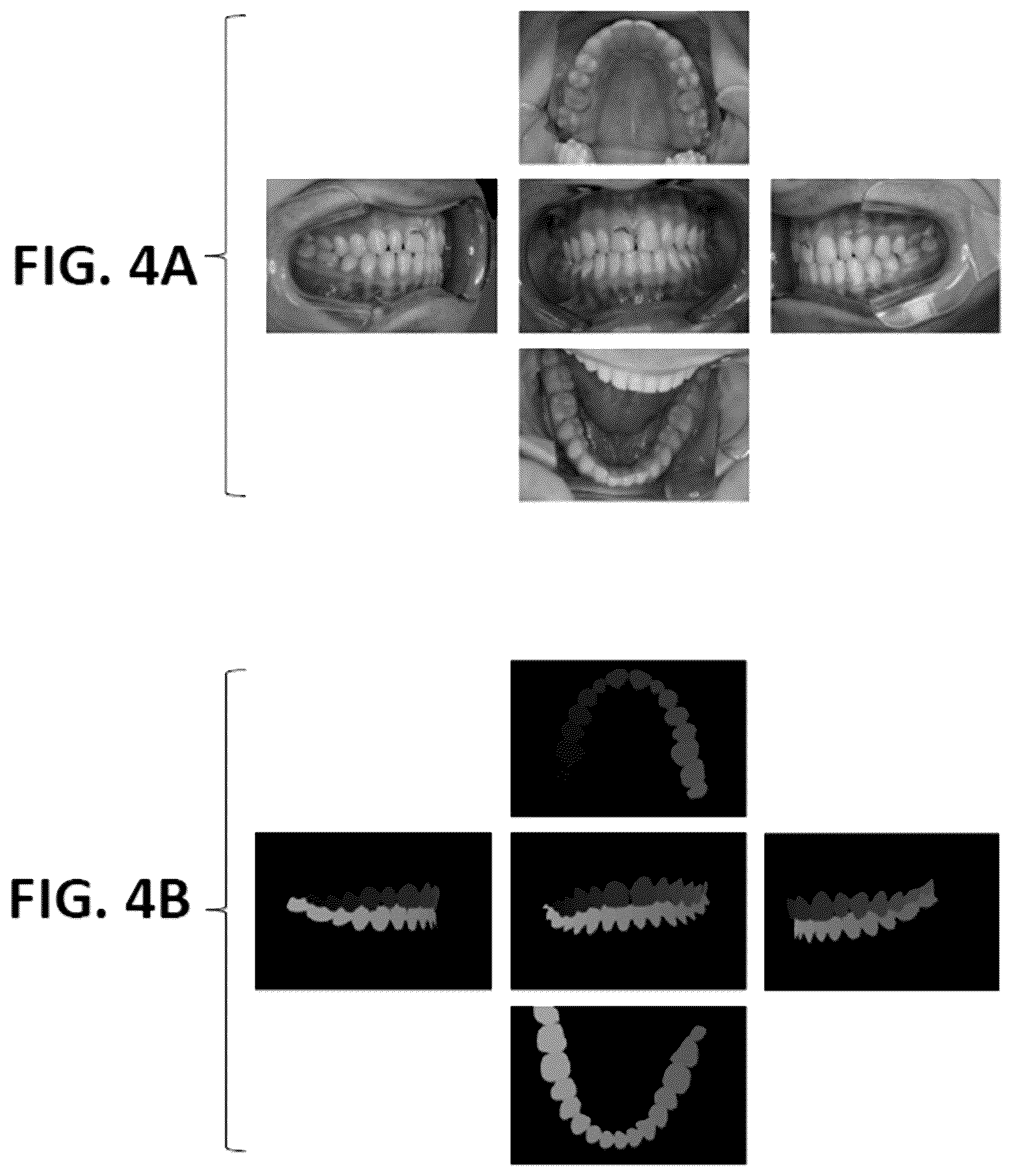 Patent US12376943 Figure 9 – Methods and systems for forming a three-dimensional model of dentition