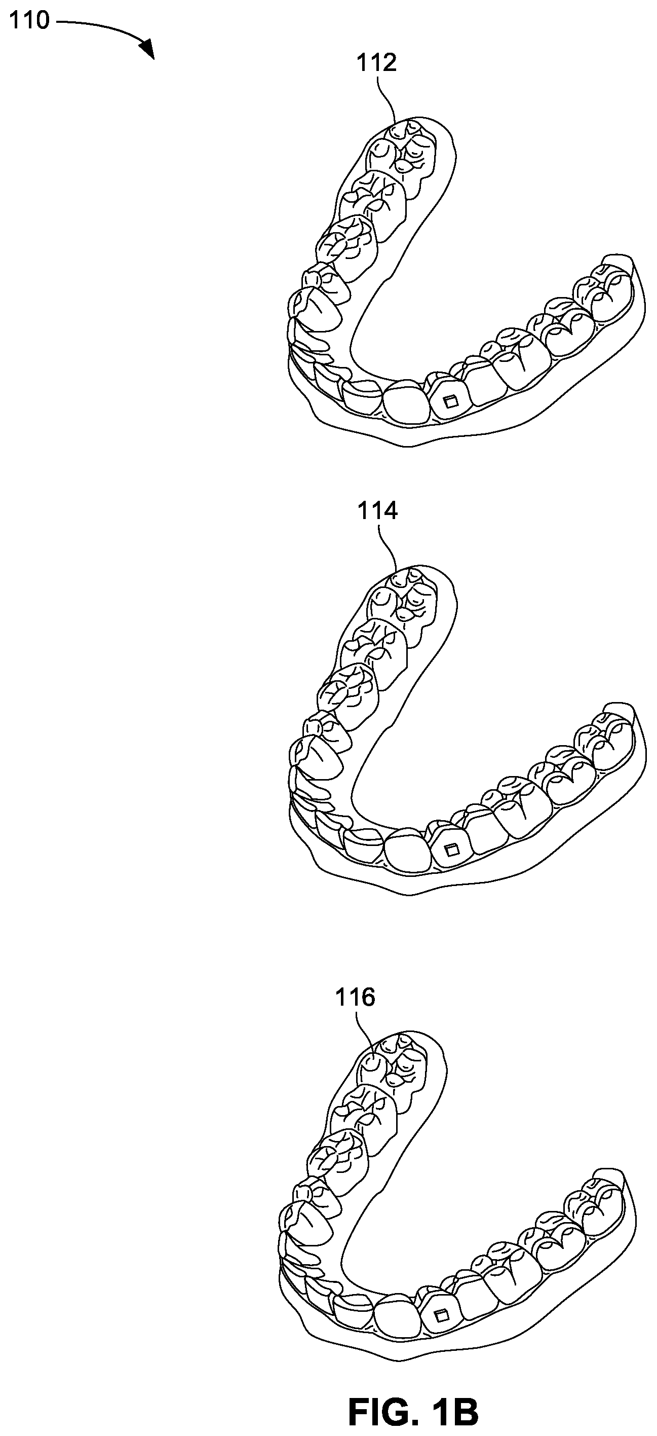 Patent US12376945 Figure 2 – Orthodontic appliances with discontinuities and elastics