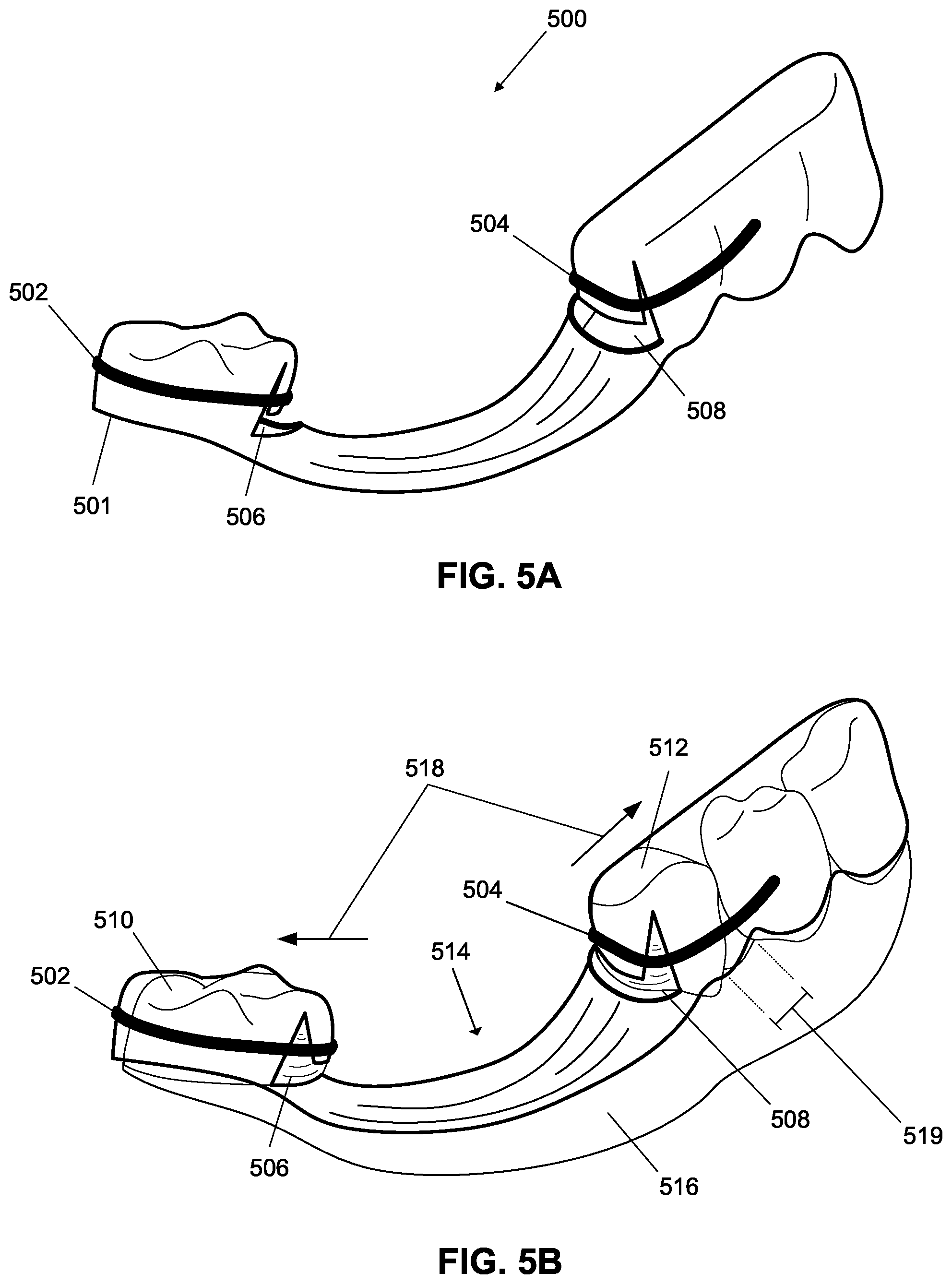 Patent US12376945 Figure 11 – Orthodontic appliances with discontinuities and elastics