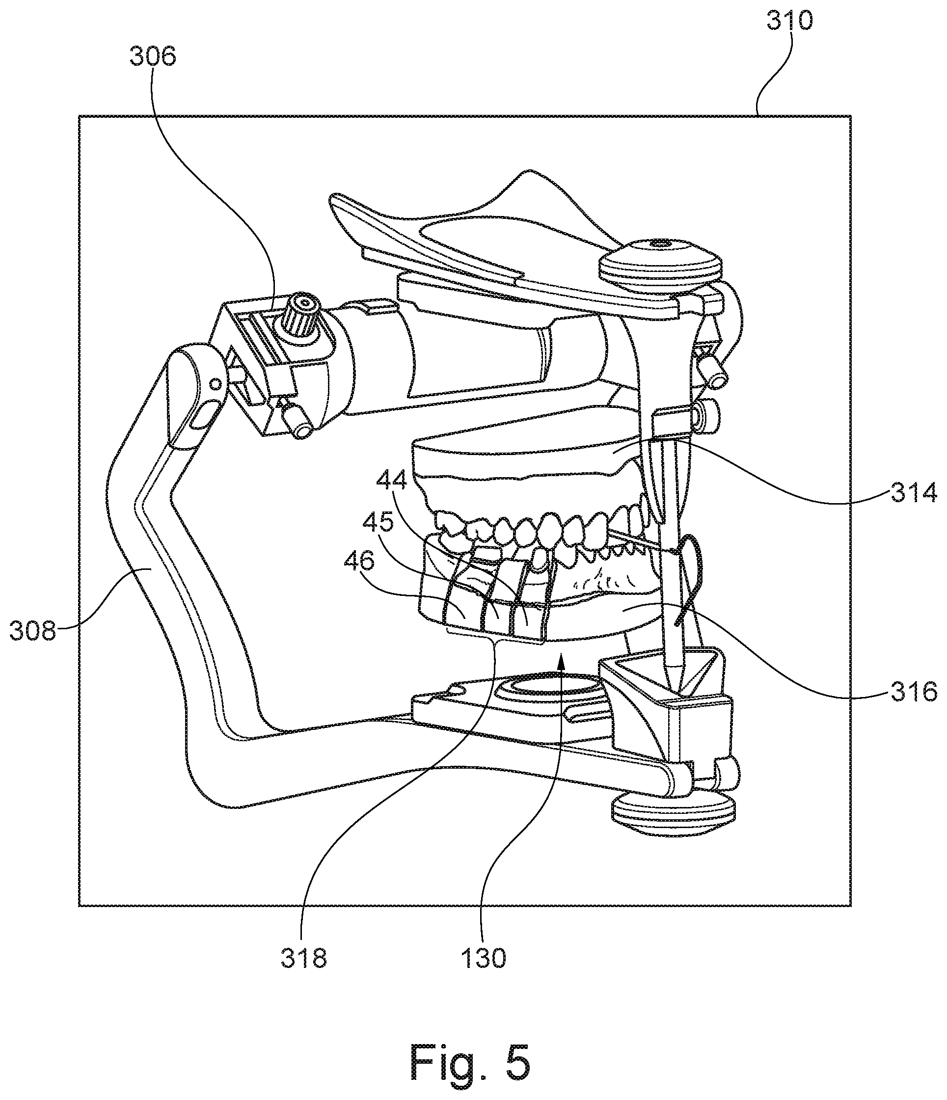 Patent US12376946 Figure 5 – Control of virtual objects using a dental articulator