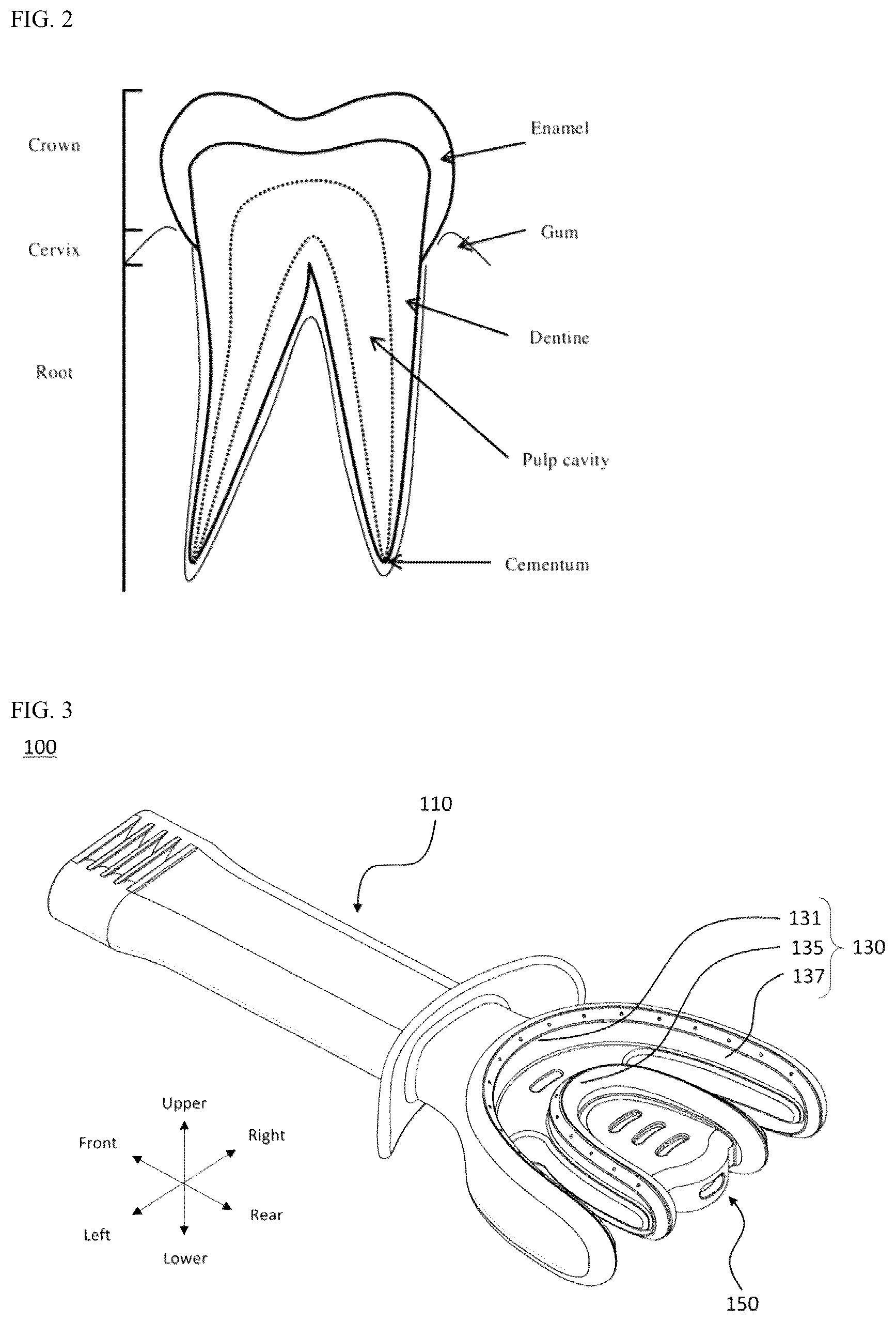 Patent US12376947 Figure 2 – Oral cavity cleaner for automatically sucking contaminated water for washing oral cavity