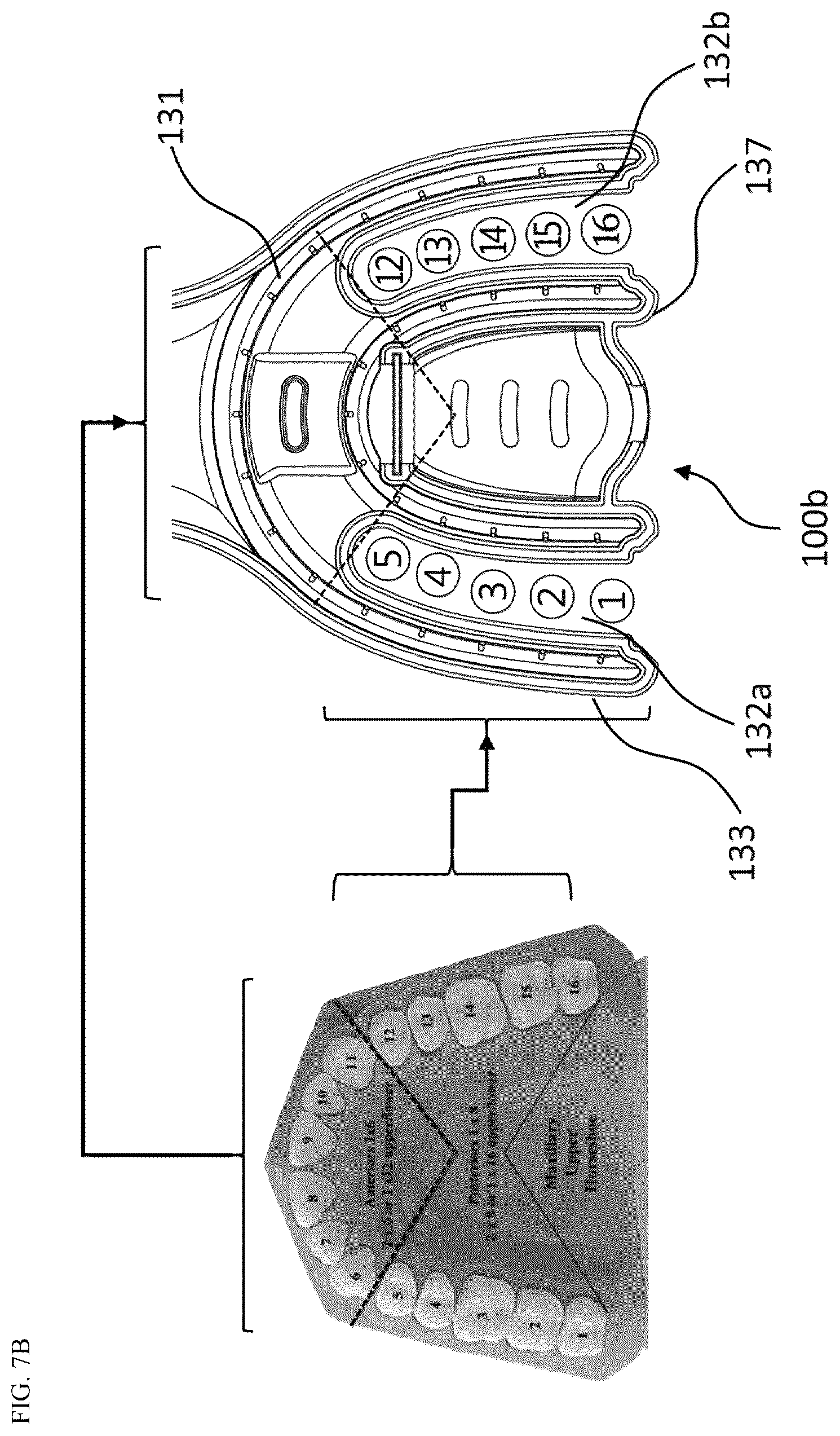 Patent US12376947 Figure 7 – Oral cavity cleaner for automatically sucking contaminated water for washing oral cavity