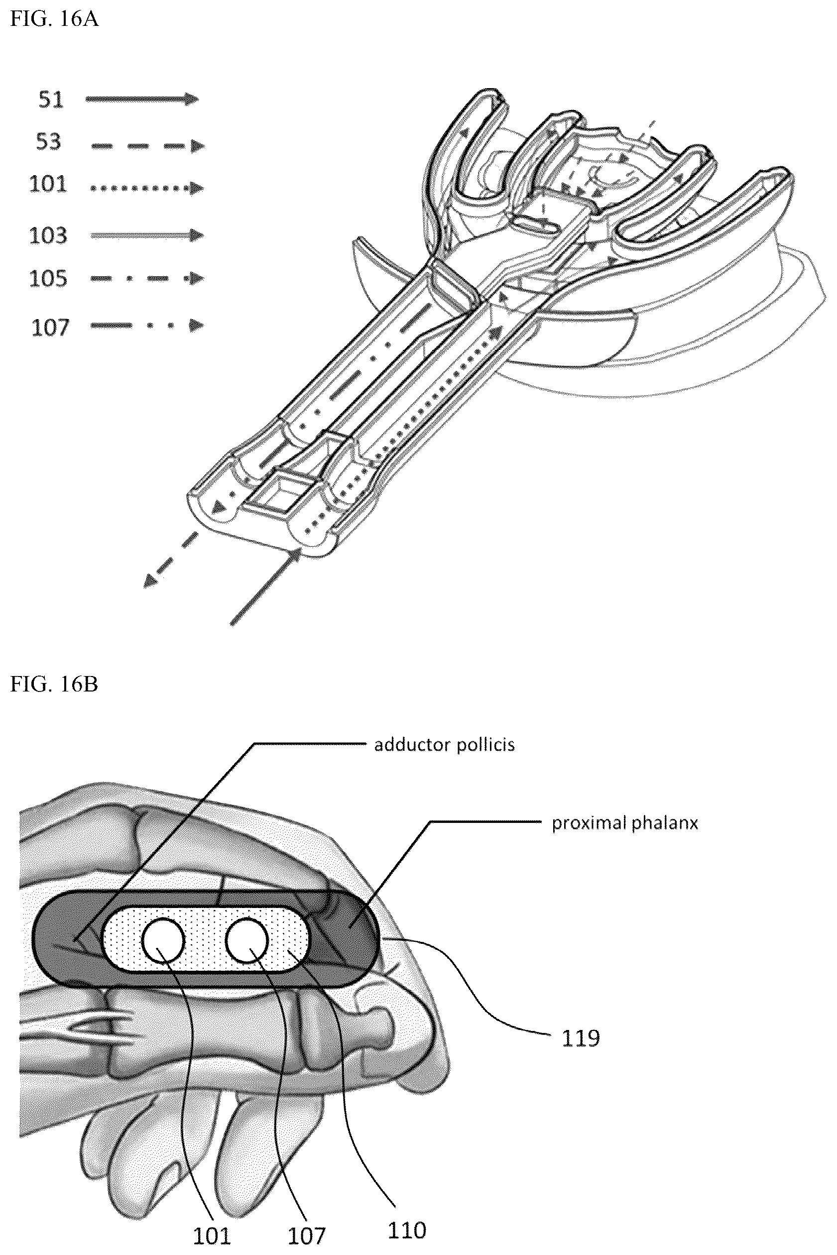 Patent US12376947 Figure 16 – Oral cavity cleaner for automatically sucking contaminated water for washing oral cavity