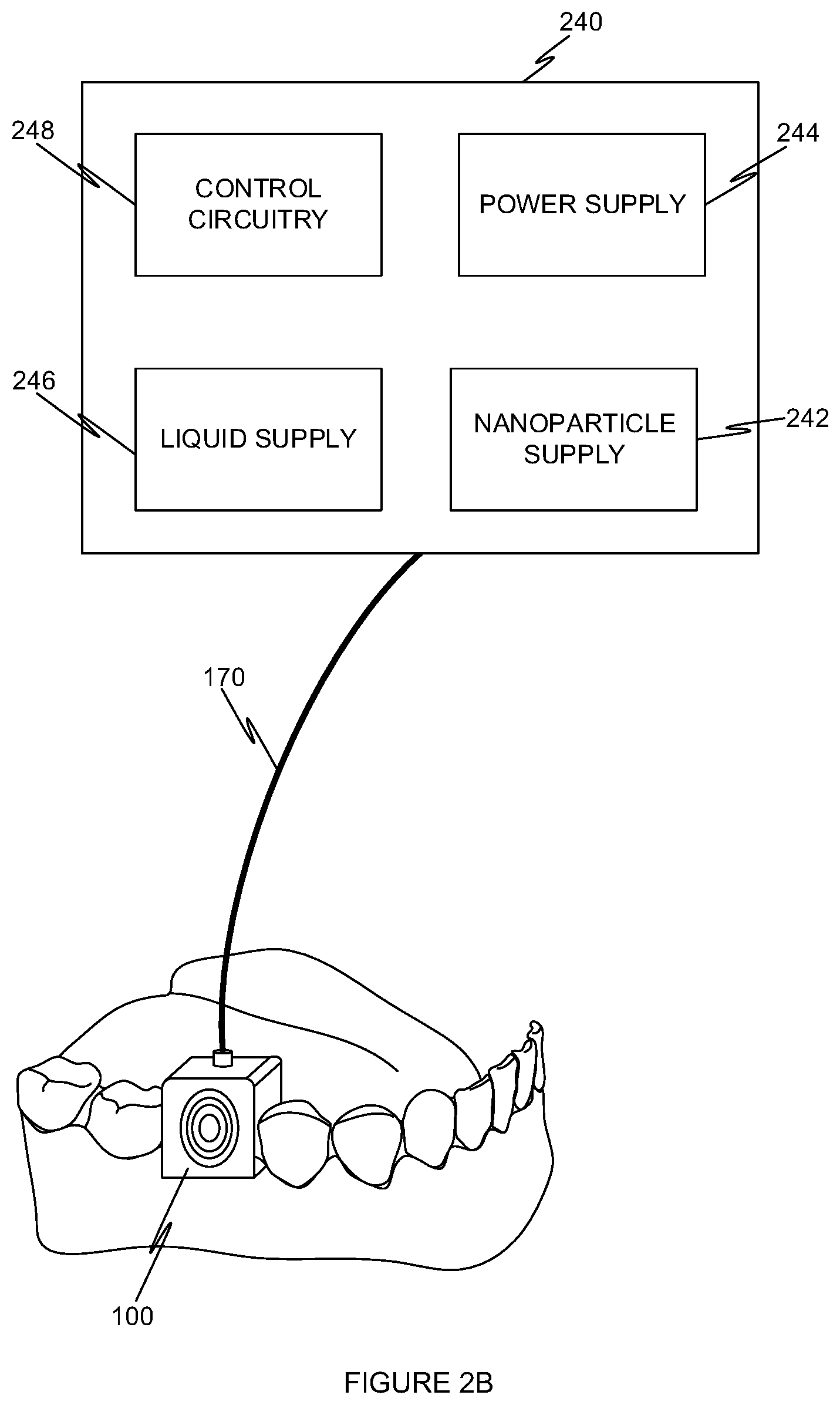 Patent US12376948 Figure 3 – Ultrasonic cleaning device
