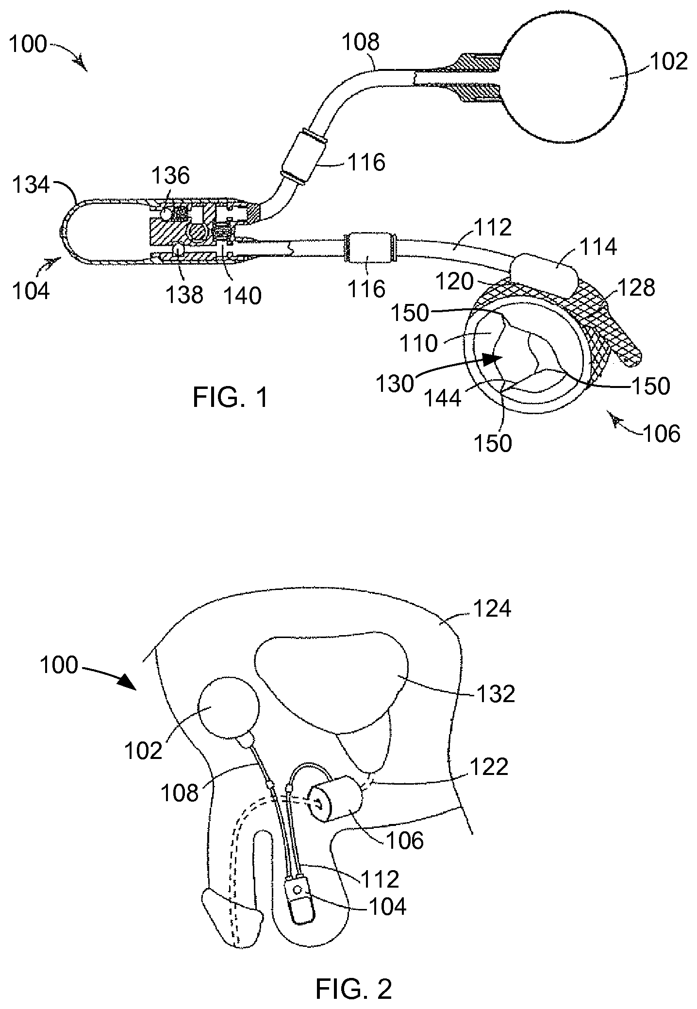 Patent US12376953 Figure 1 – Biased artificial sphincter cuff