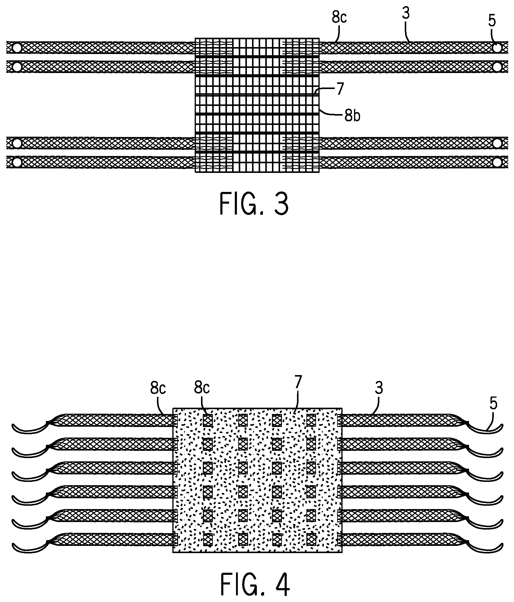 Patent US12376954 Figure 2 – Implantable mesh and method of use