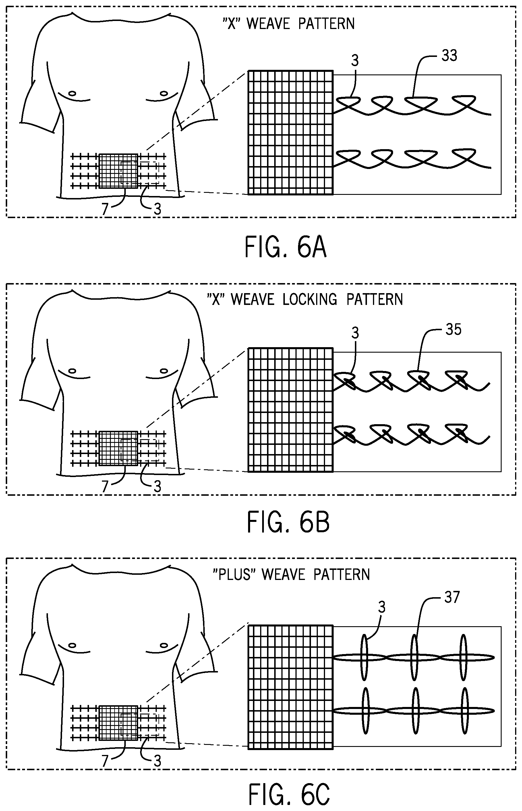 Patent US12376954 Figure 4 – Implantable mesh and method of use