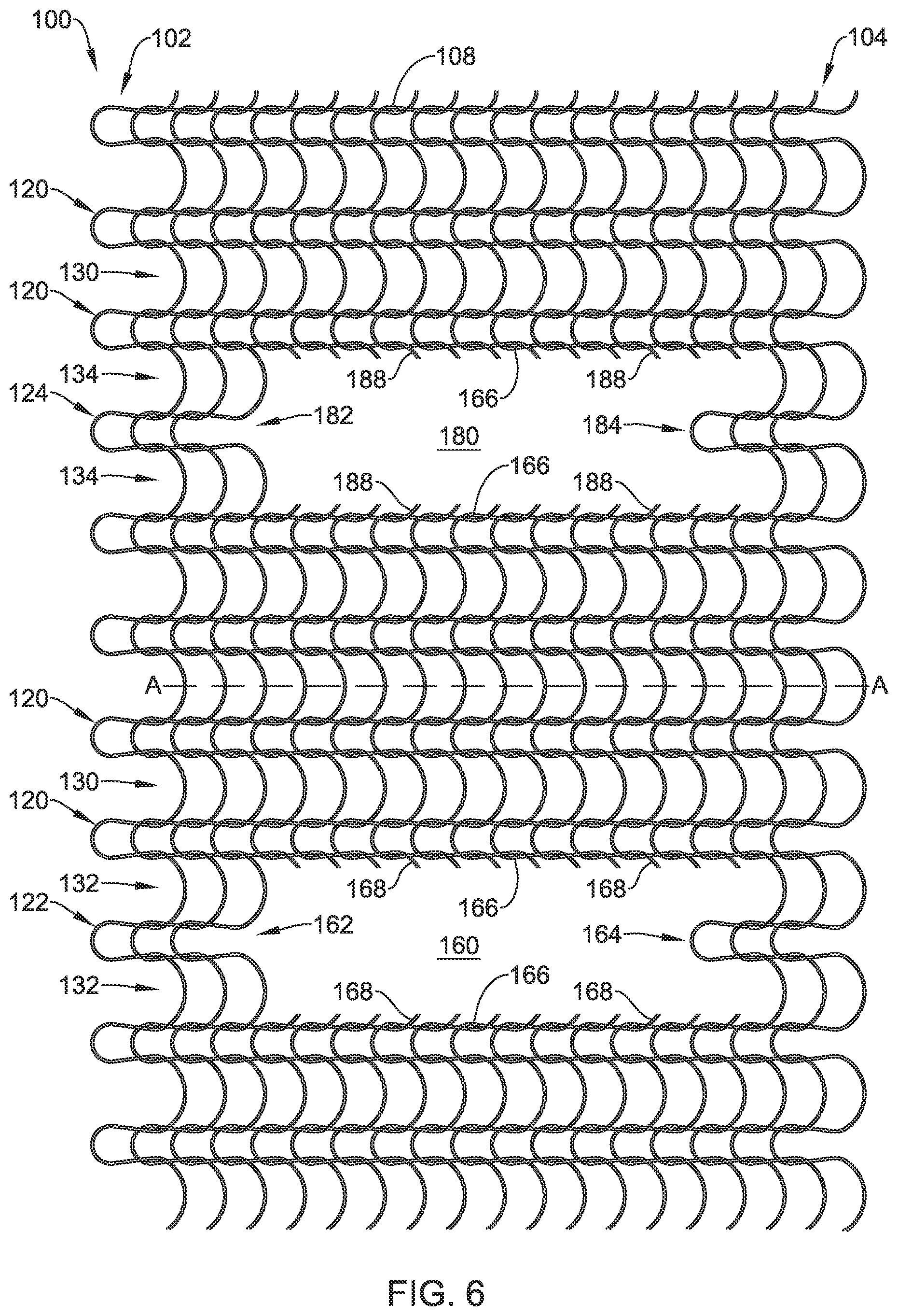 Patent US12376955 Figure 6 – Endoprosthesis with stress reducing features