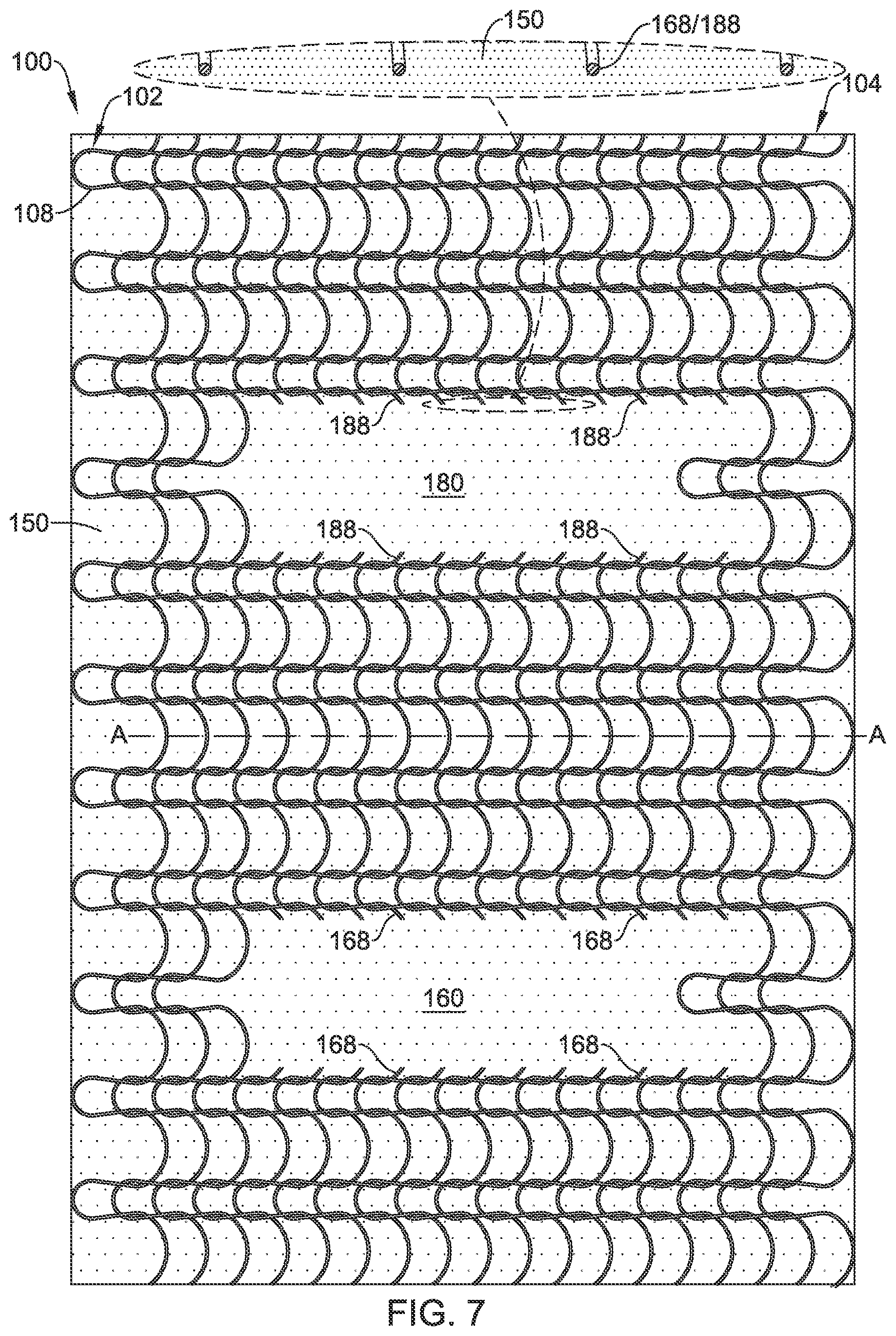 Patent US12376955 Figure 7 – Endoprosthesis with stress reducing features
