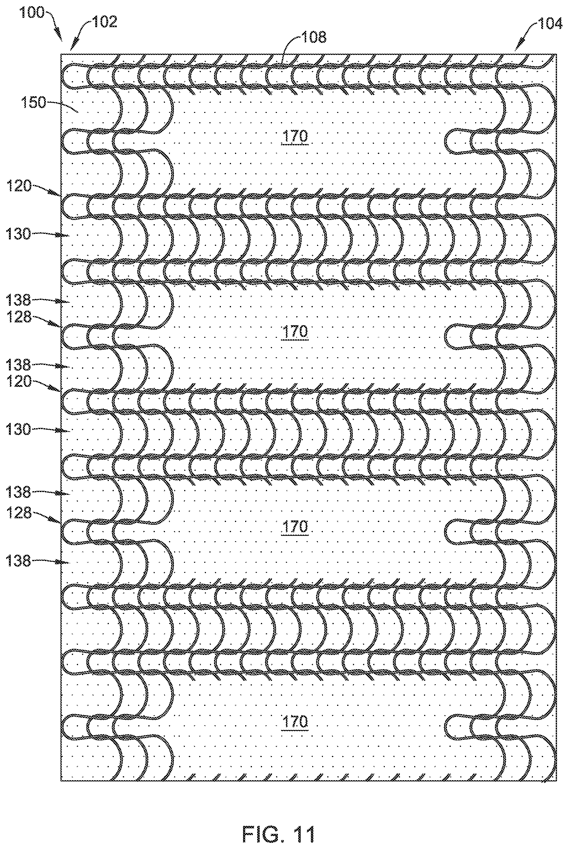 Patent US12376955 Figure 11 – Endoprosthesis with stress reducing features