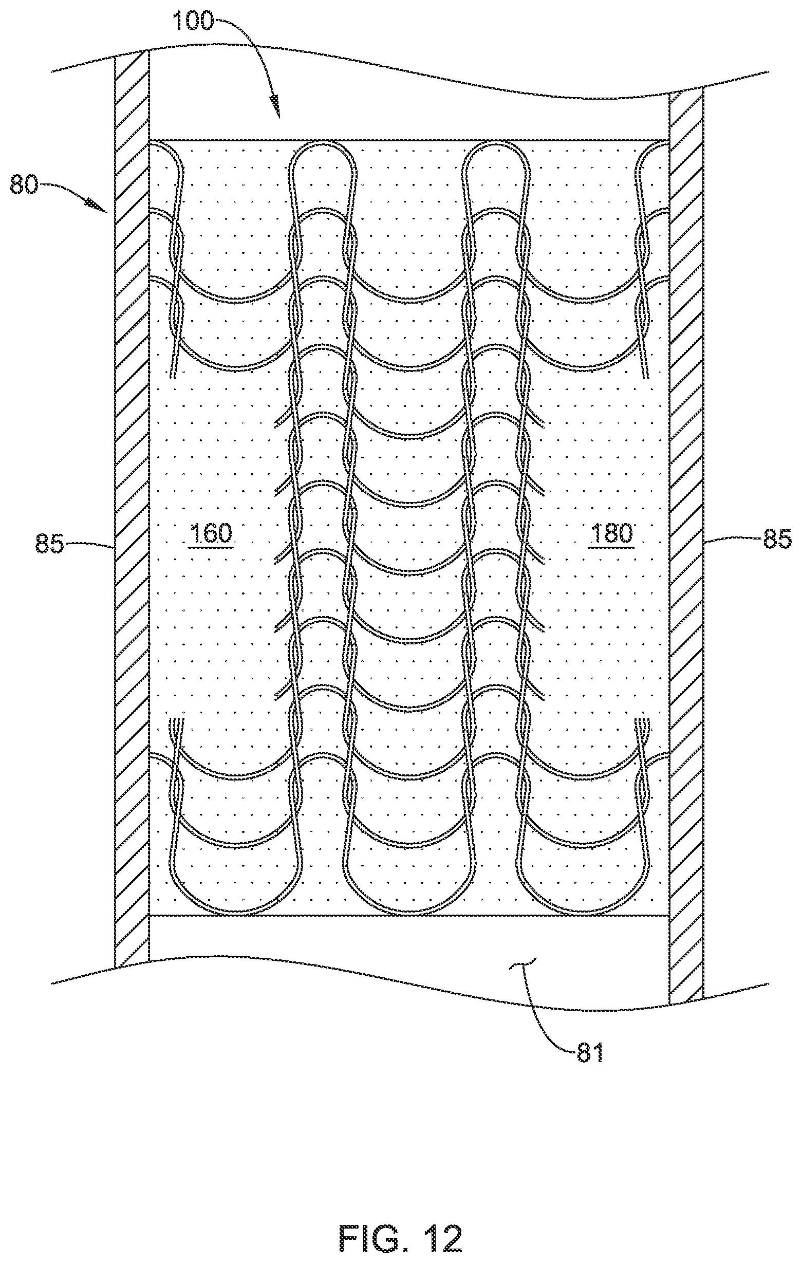Patent US12376955 Figure 12 – Endoprosthesis with stress reducing features