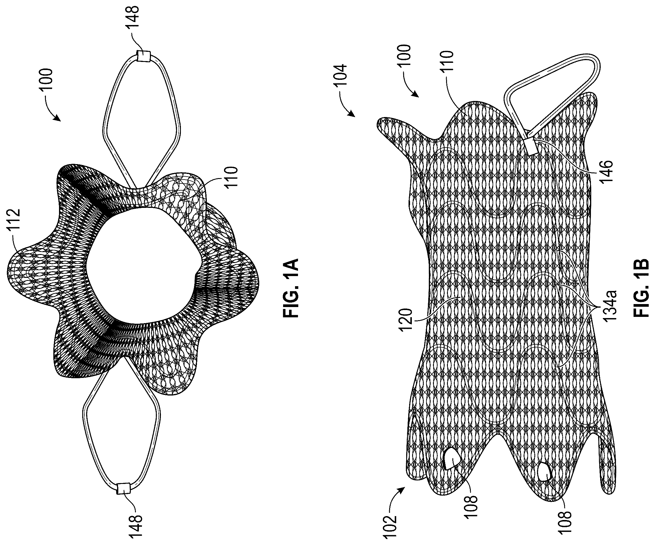 Patent US12376956 Figure 1 – Percutaneous shunt devices and related methods
