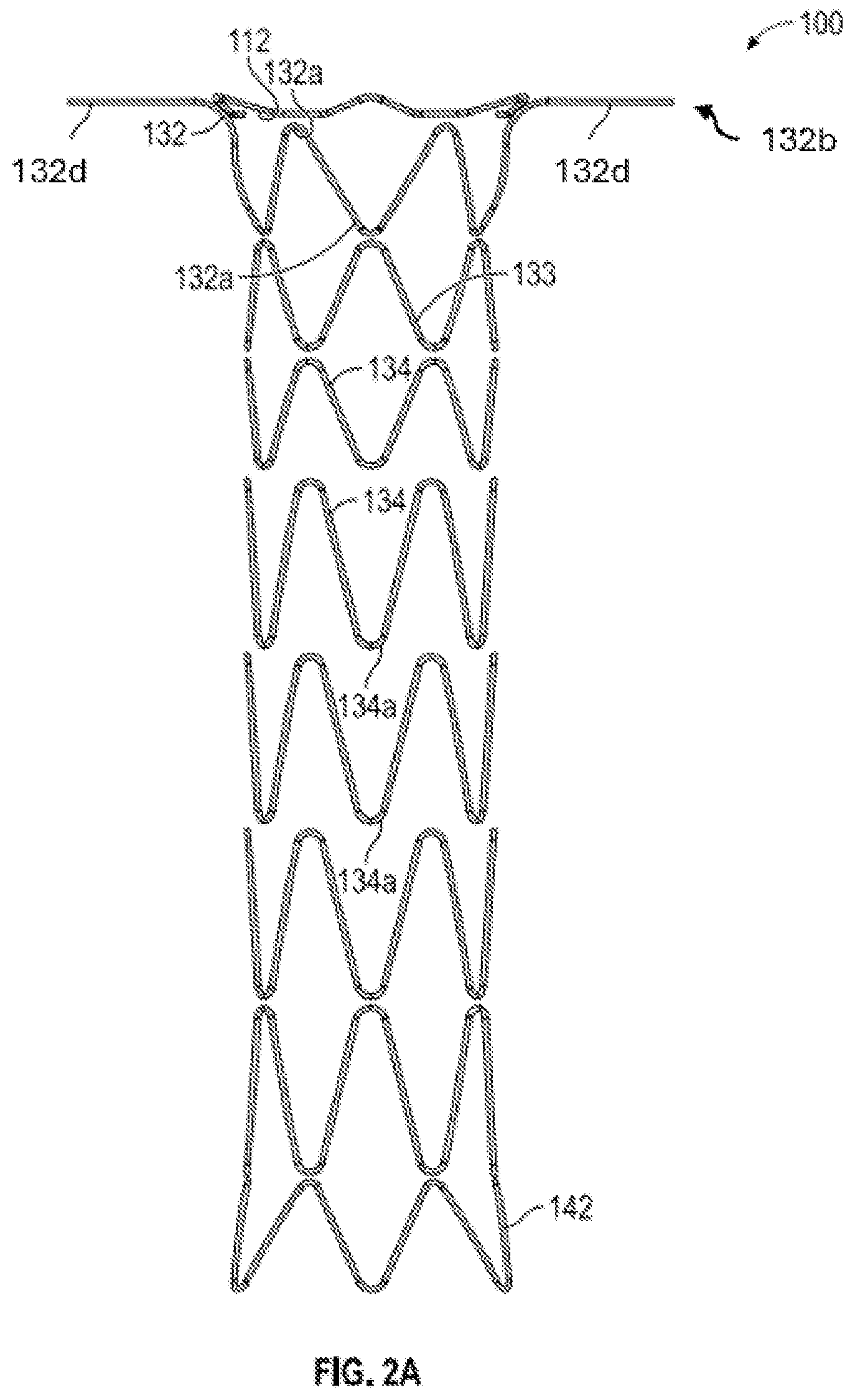 Patent US12376956 Figure 3 – Percutaneous shunt devices and related methods