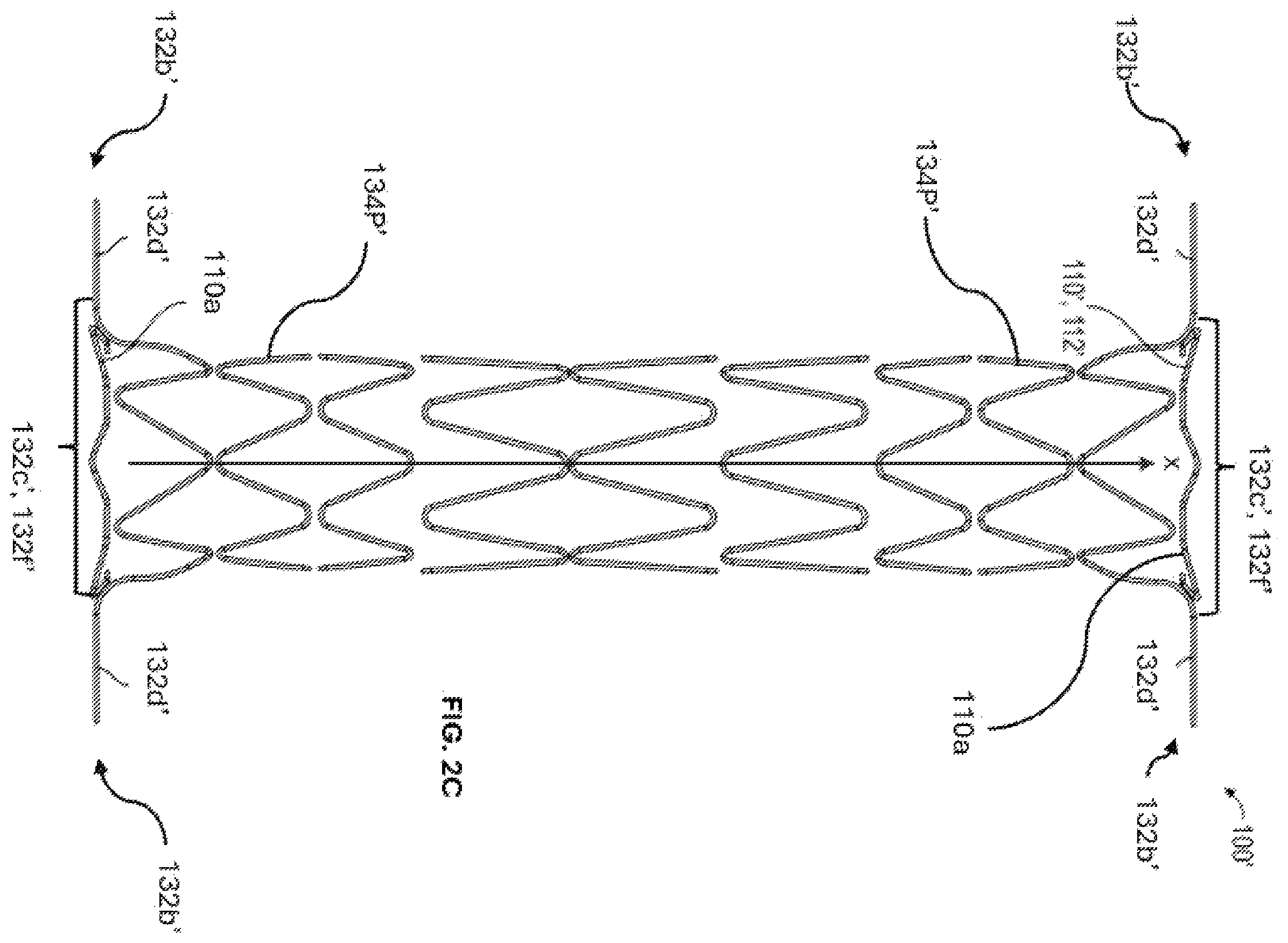 Patent US12376956 Figure 5 – Percutaneous shunt devices and related methods