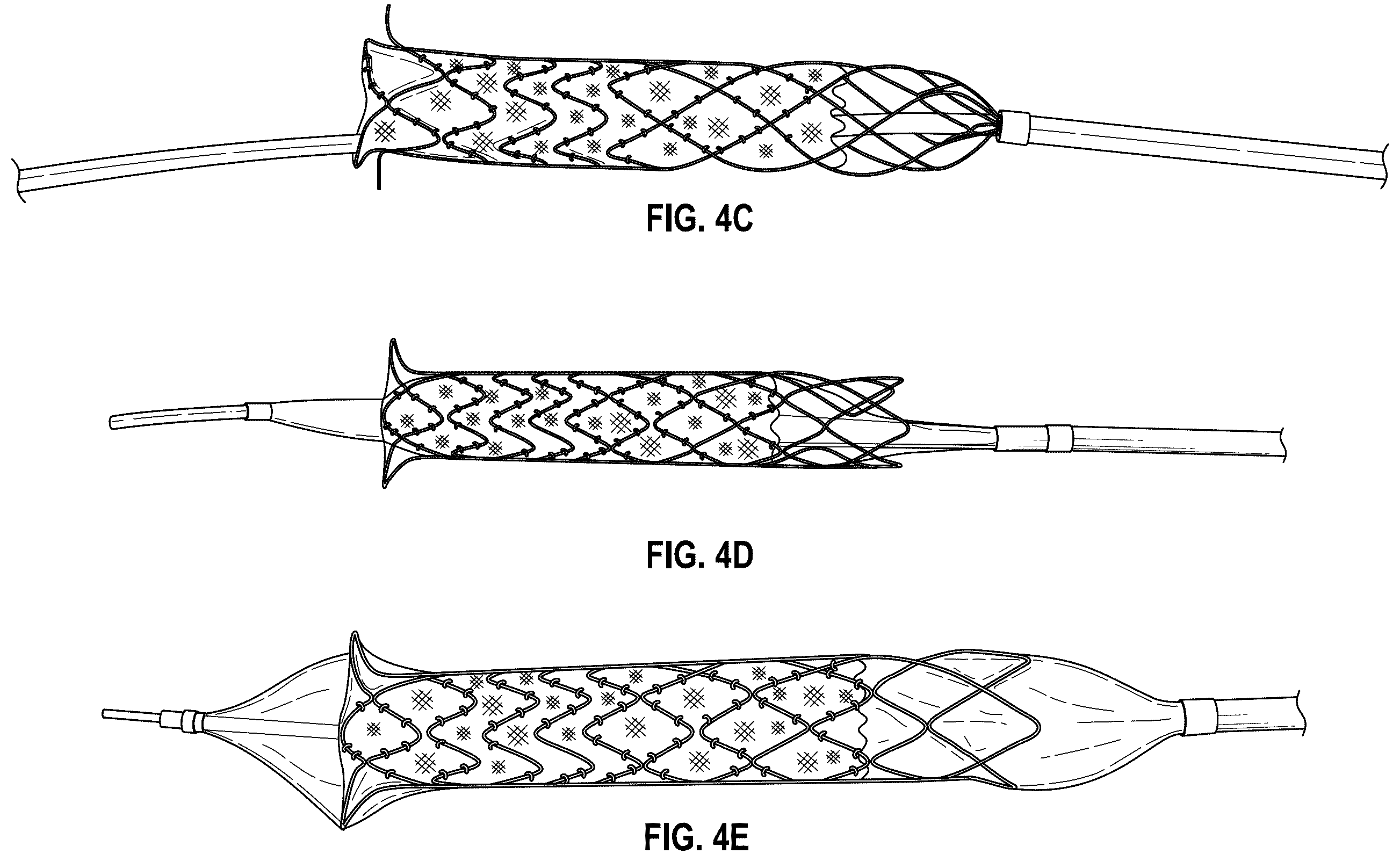 Patent US12376956 Figure 8 – Percutaneous shunt devices and related methods