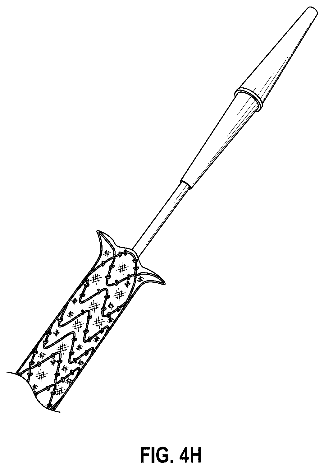 Patent US12376956 Figure 10 – Percutaneous shunt devices and related methods