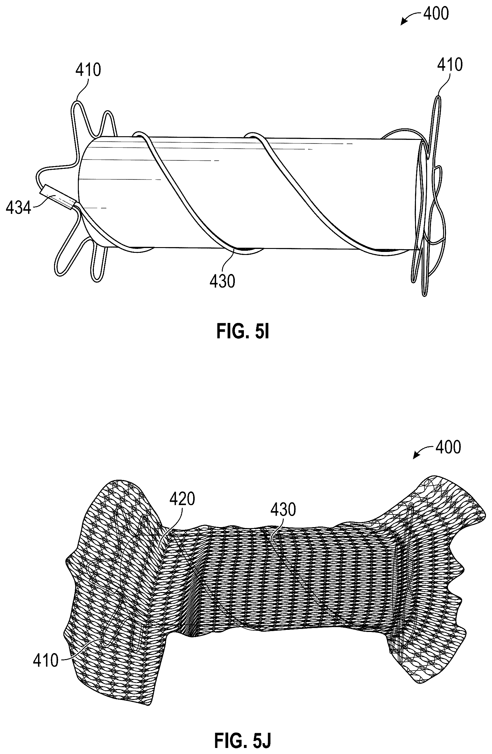 Patent US12376956 Figure 15 – Percutaneous shunt devices and related methods