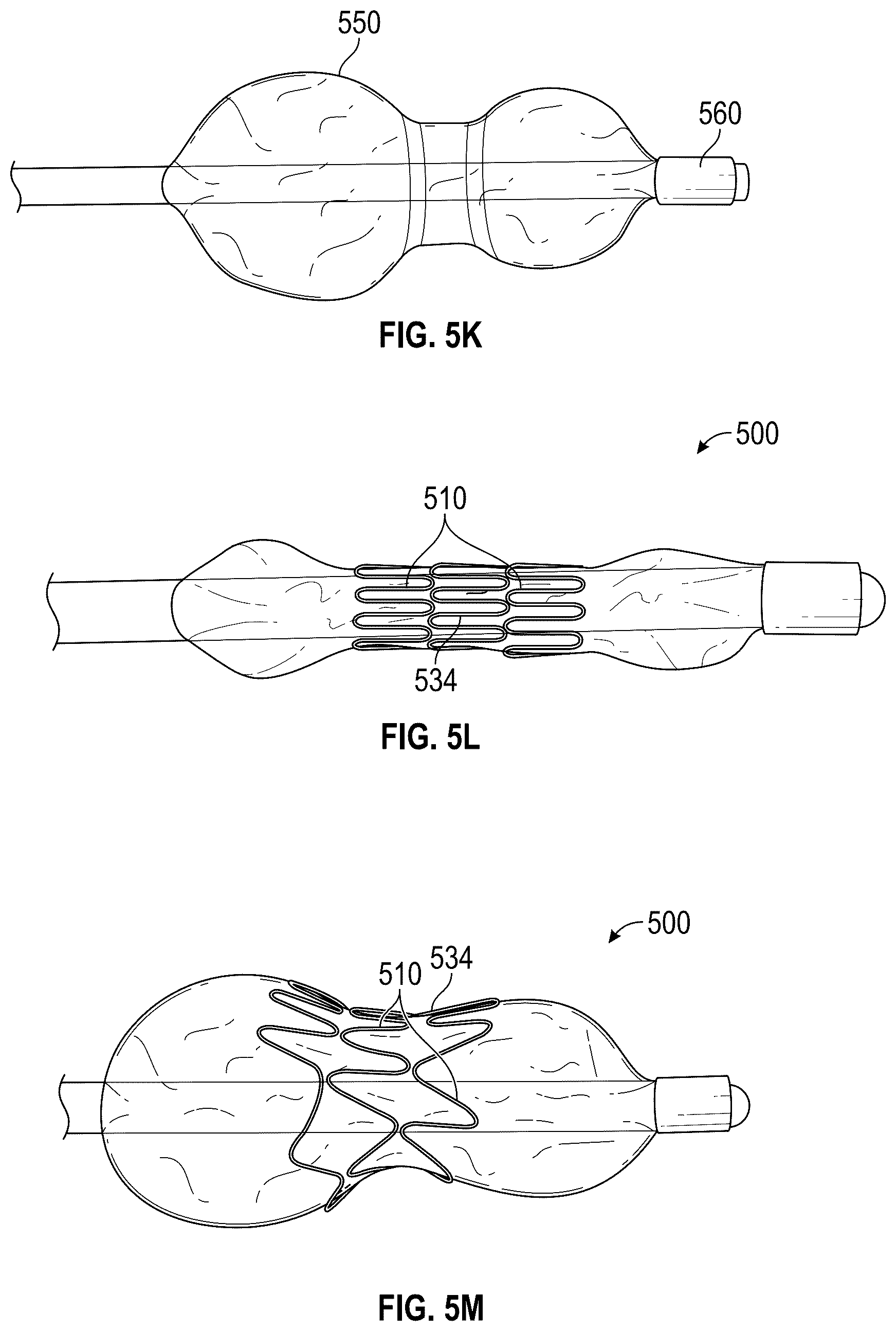 Patent US12376956 Figure 16 – Percutaneous shunt devices and related methods