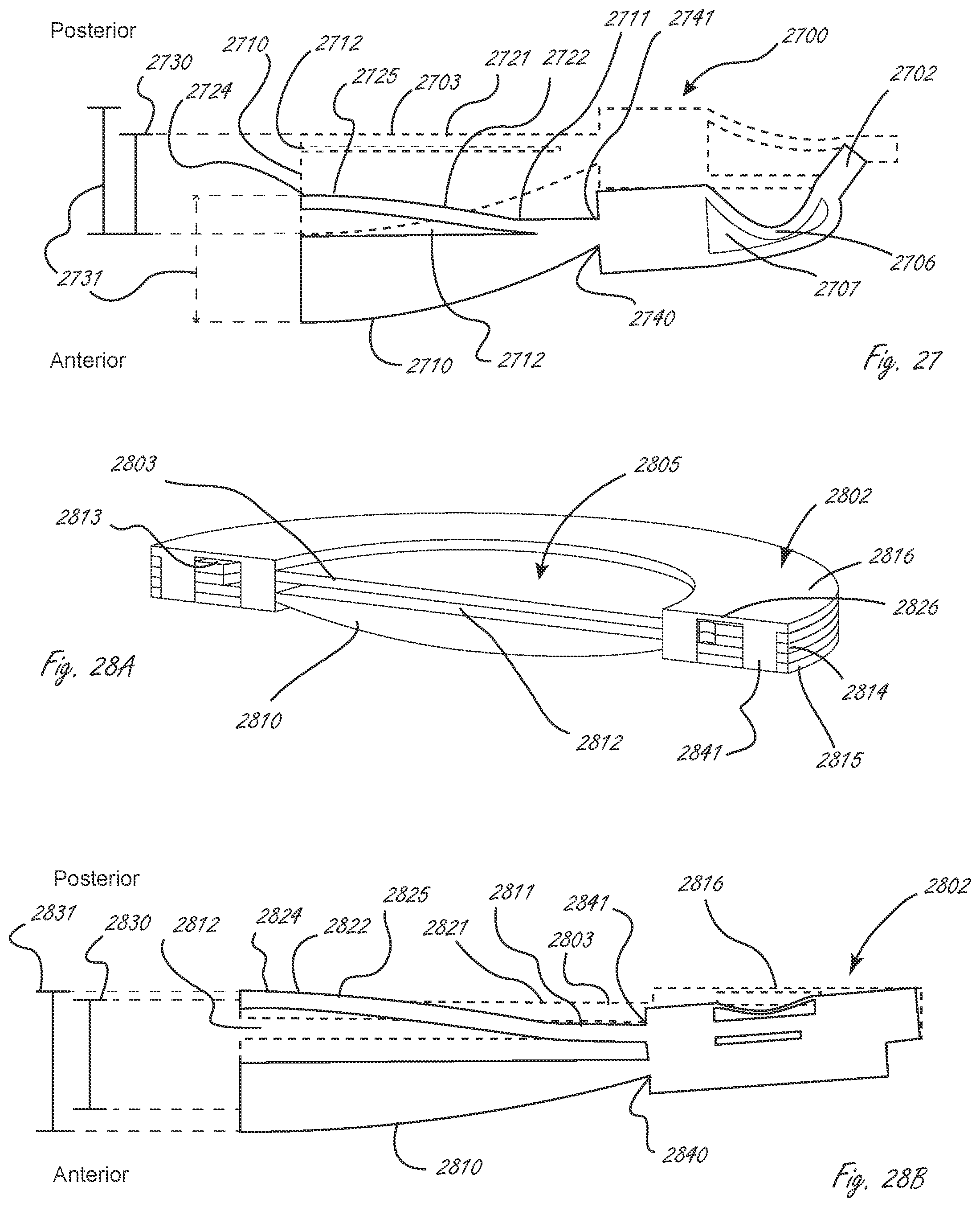 Patent US12376957 Figure 11 – Multi-piece accommodating intraocular lens
