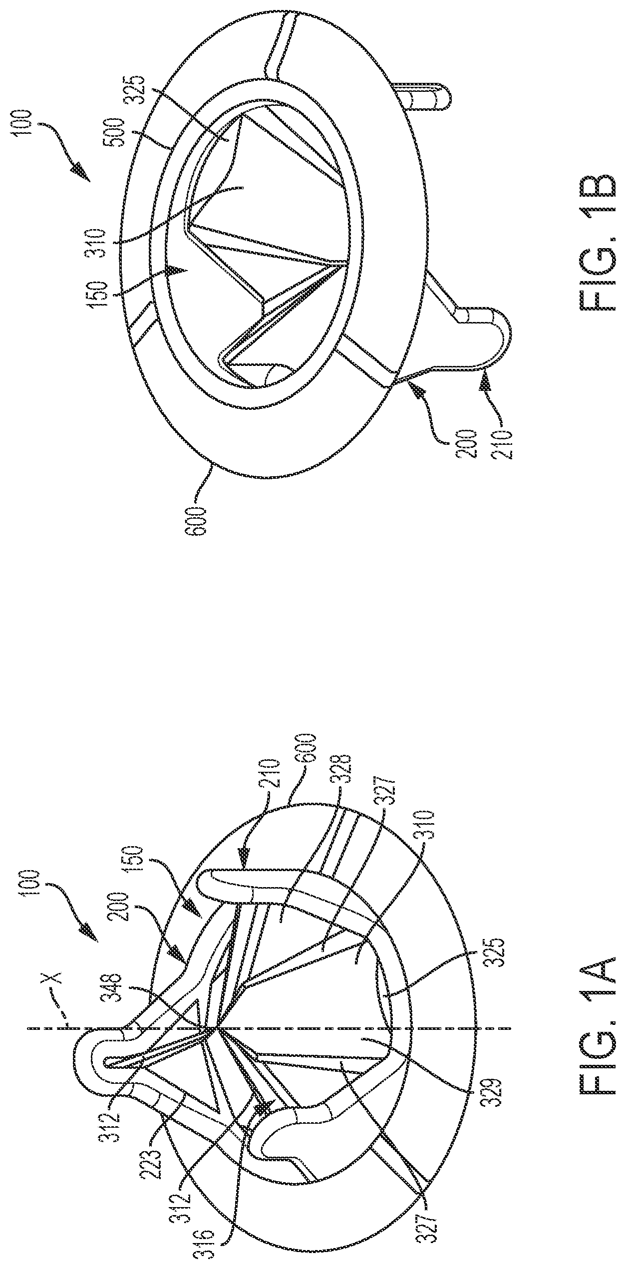 Patent US12376959 Figure 1 – Suture guard for a prosthetic valve