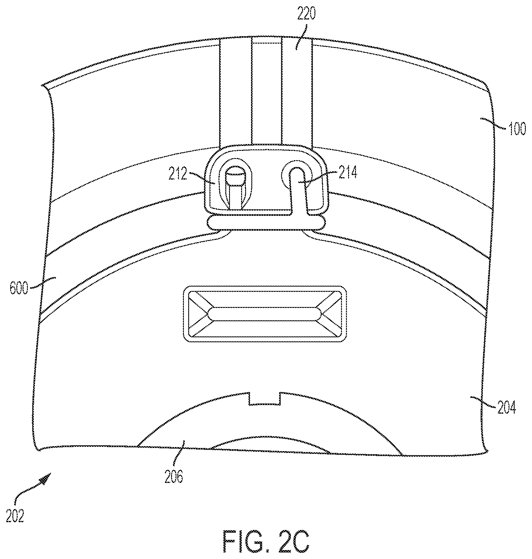 Patent US12376959 Figure 4 – Suture guard for a prosthetic valve