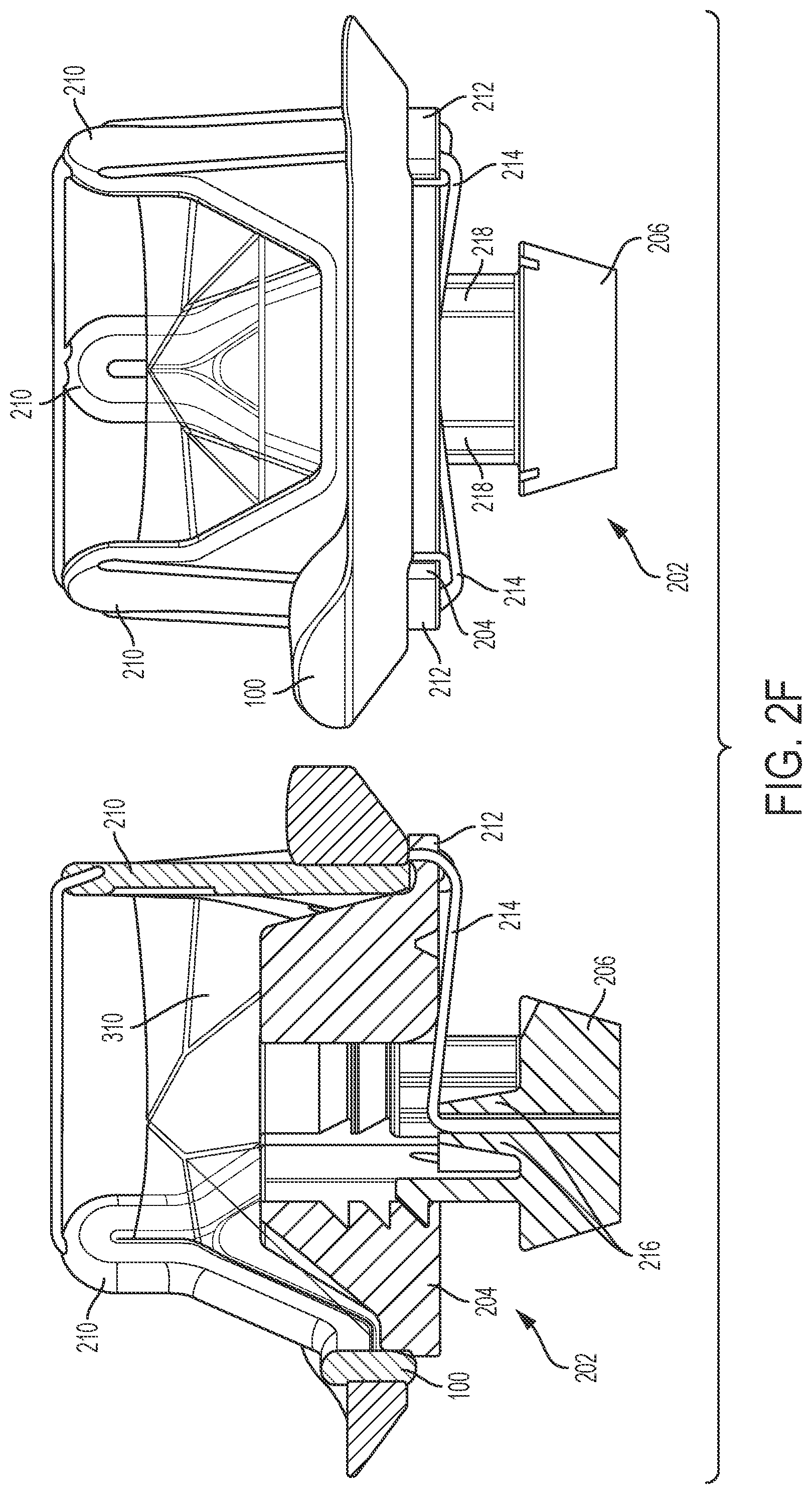 Patent US12376959 Figure 7 – Suture guard for a prosthetic valve