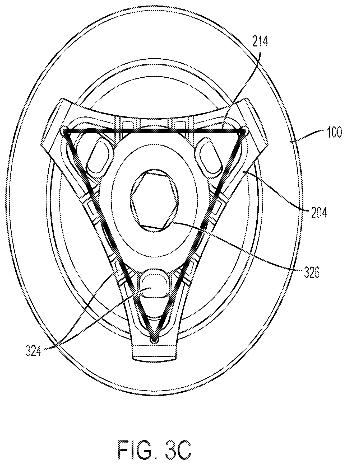 Patent US12376959 Figure 11 – Suture guard for a prosthetic valve