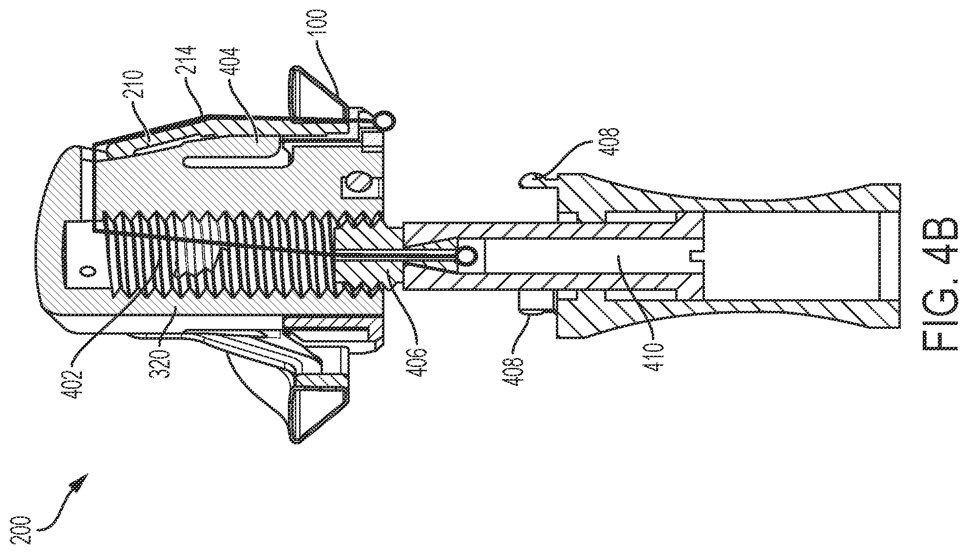 Patent US12376959 Figure 13 – Suture guard for a prosthetic valve