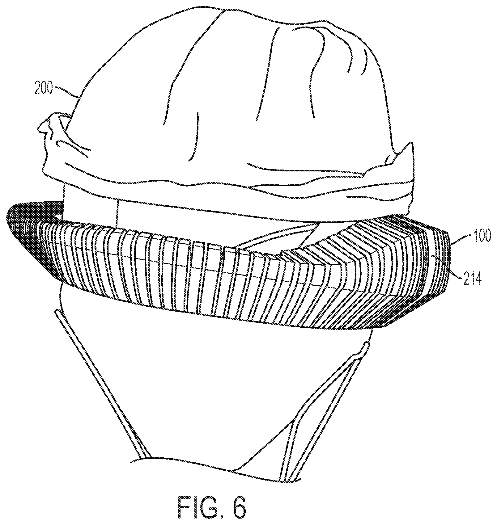 Patent US12376959 Figure 15 – Suture guard for a prosthetic valve