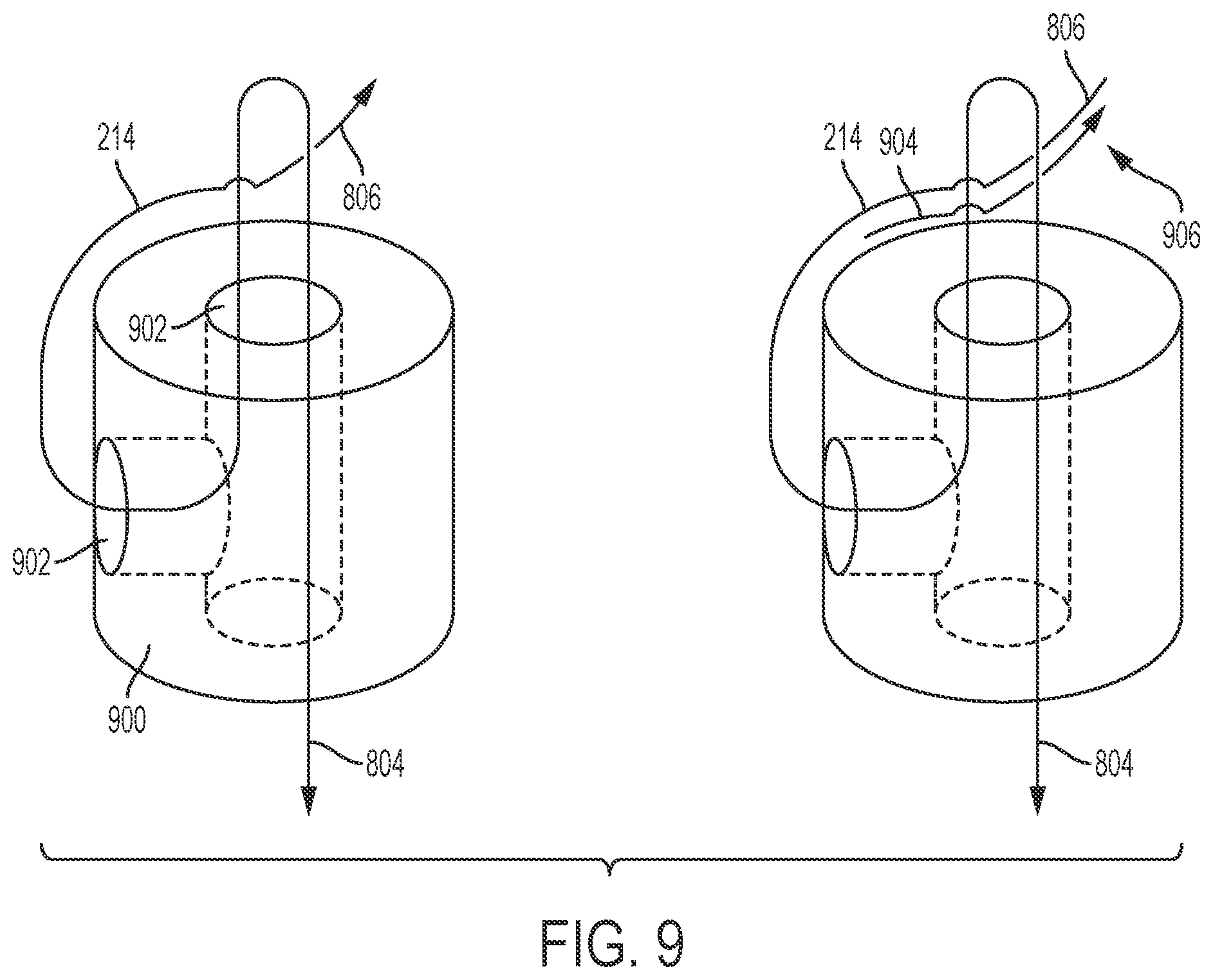 Patent US12376959 Figure 18 – Suture guard for a prosthetic valve