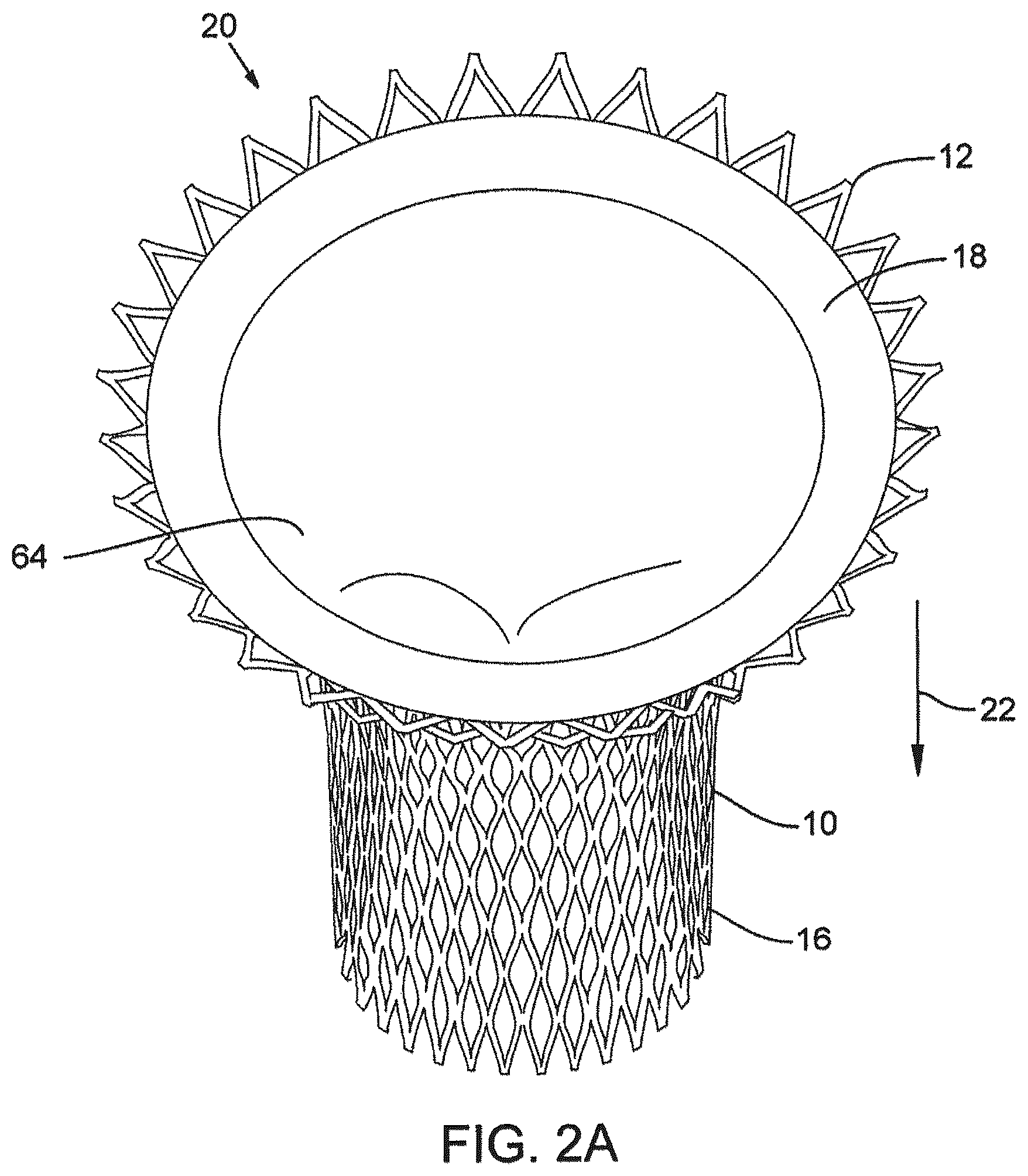 Patent US12376961 Figure 2 – Method of implanting a prosthetic heart valve assembly