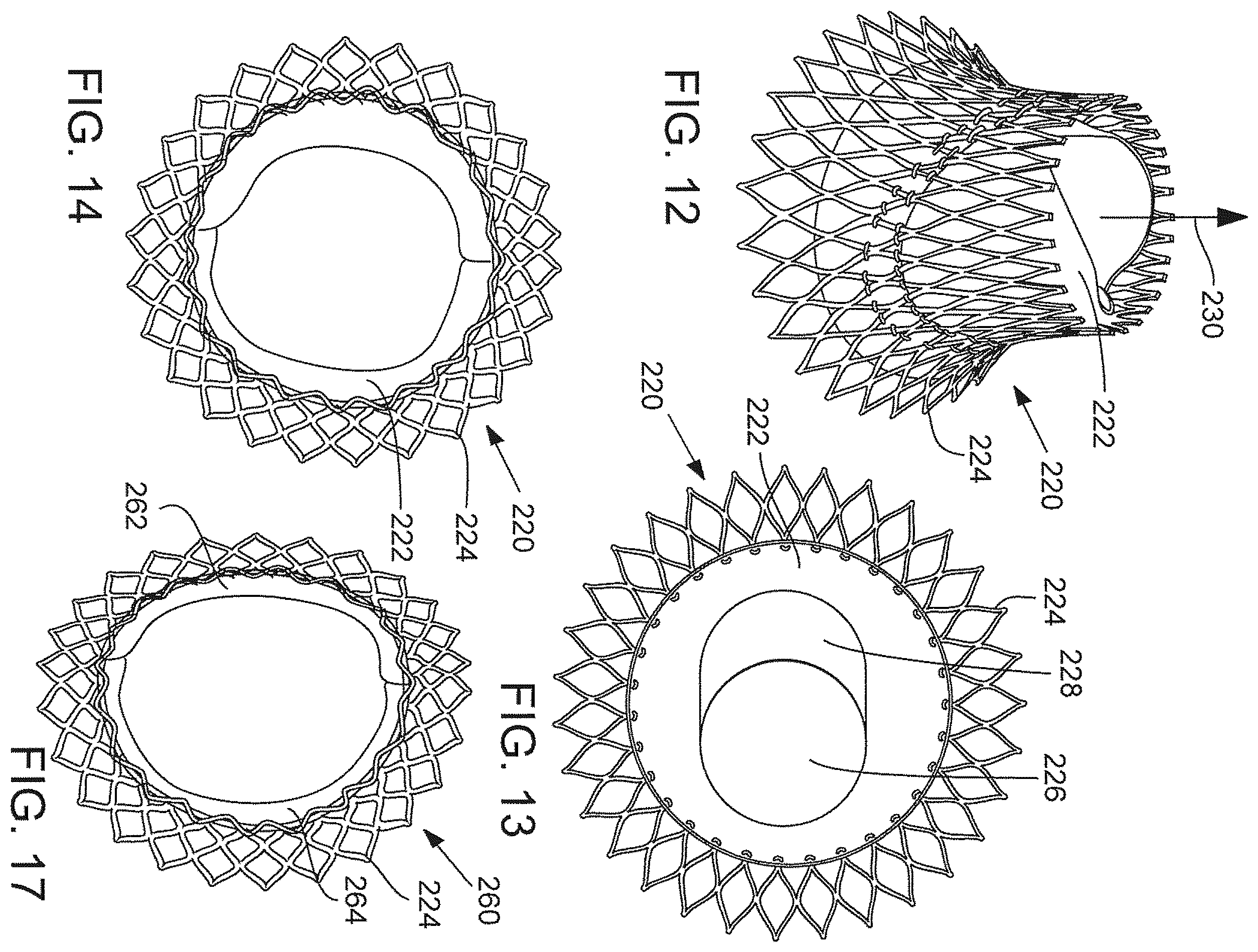Patent US12376961 Figure 15 – Method of implanting a prosthetic heart valve assembly
